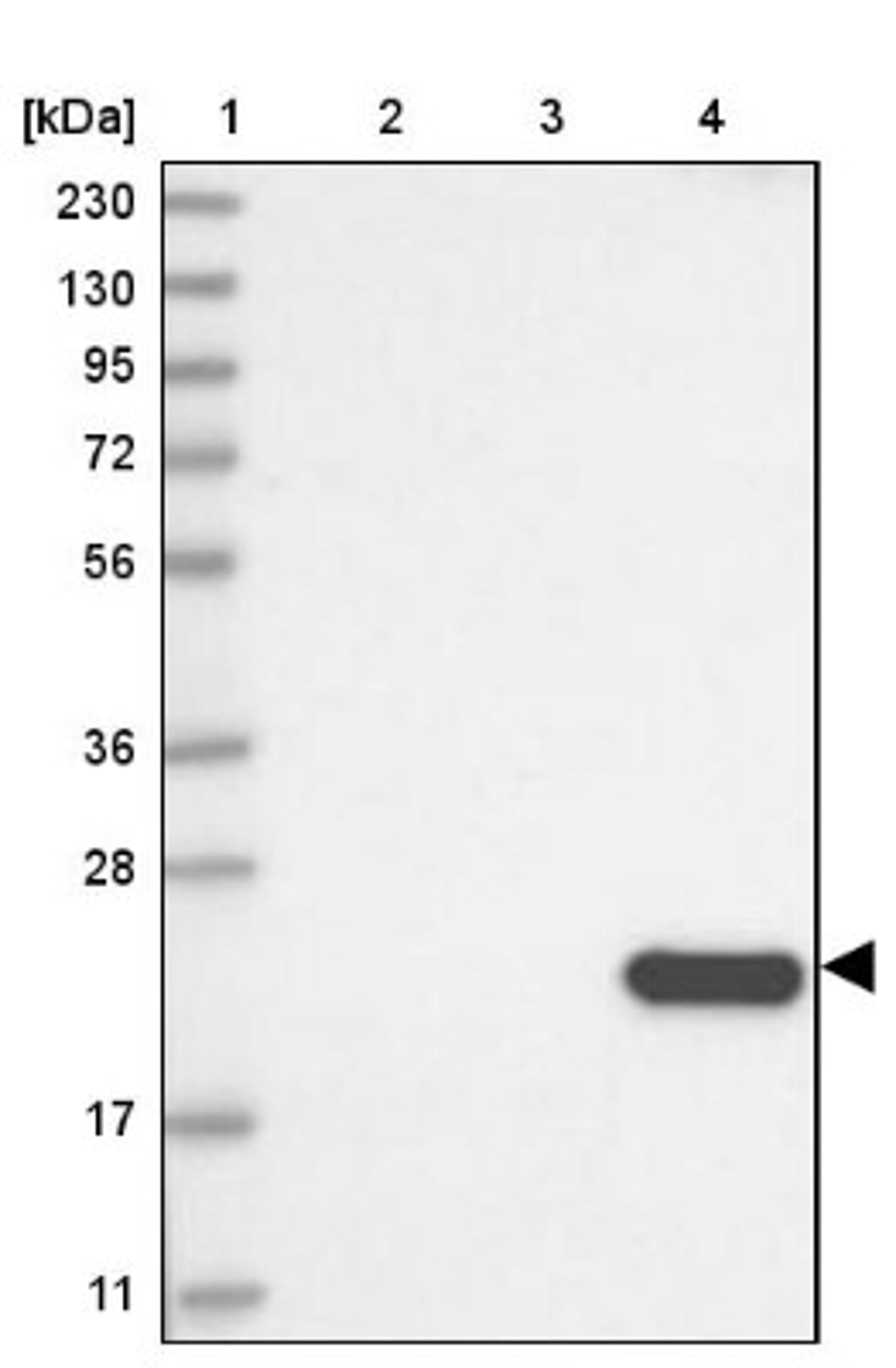 Western Blot: CLEC3B/Tetranectin Antibody [NBP2-38222] - Lane 1: Marker [kDa] 230, 130, 95, 72, 56, 36, 28, 17, 11<br/>Lane 2: RT-4<br/>Lane 3: U-251 MG<br/>Lane 4: Human Plasma