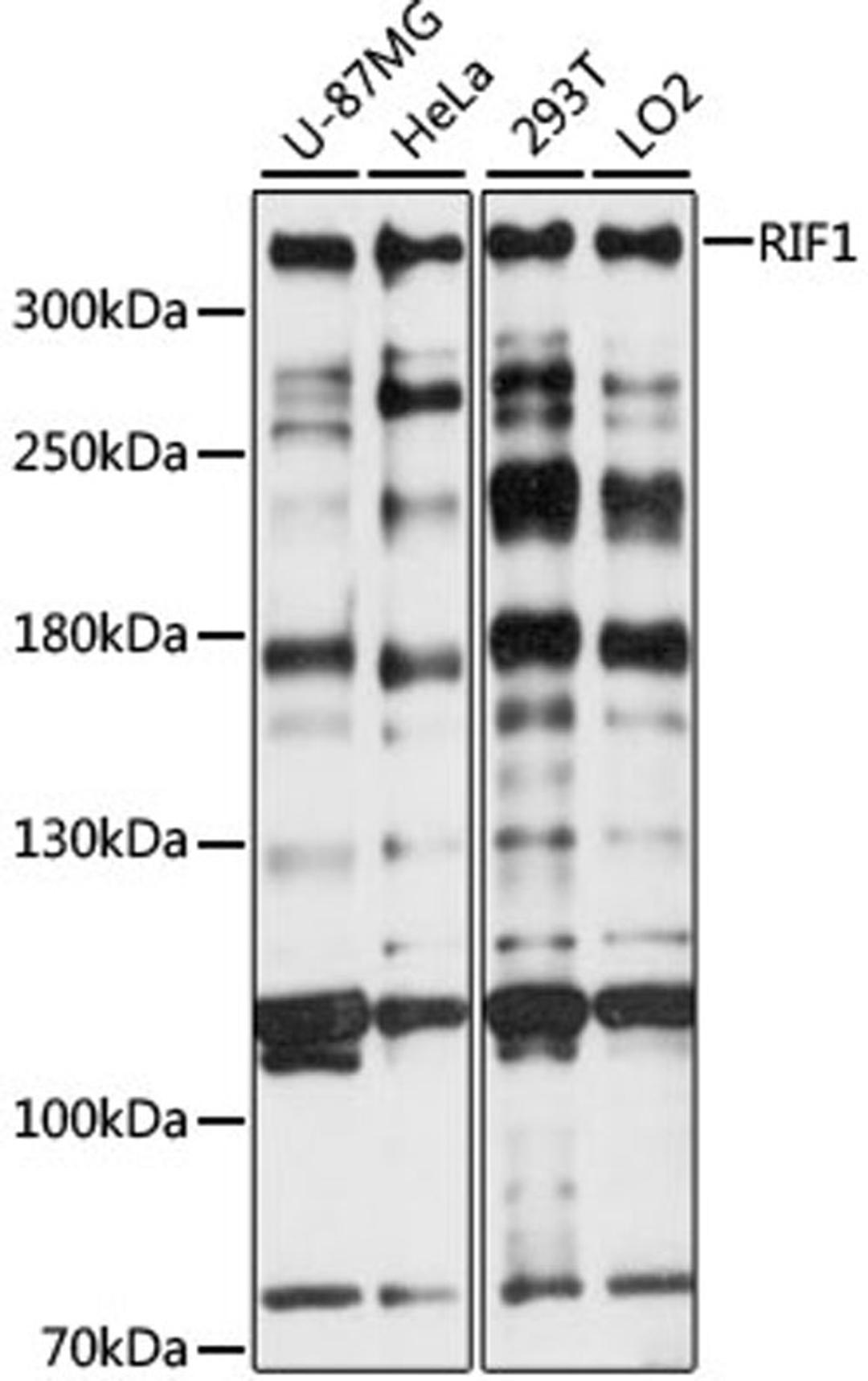 Western blot - RIF1 antibody (A15167)