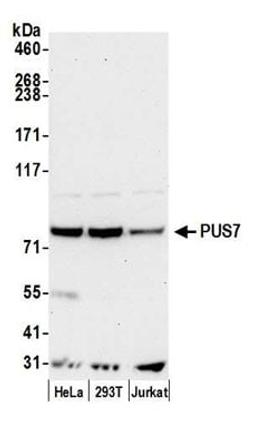 Detection of human PUS7 by western blot.