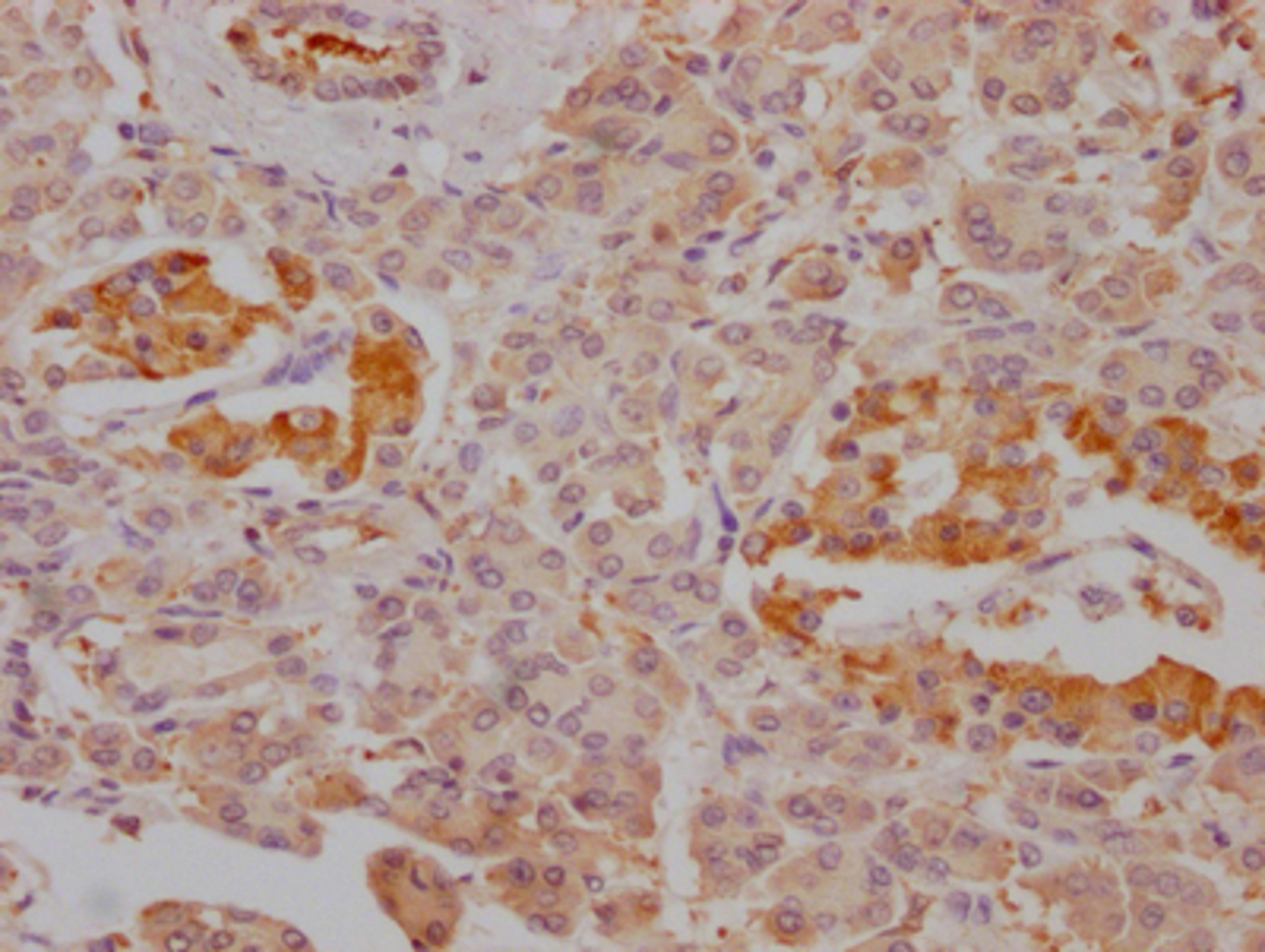 IHC image of CSB-RA787345A0HU diluted at 1:100 and staining in paraffin-embedded human pancreatic tissue performed on a Leica BondTM system. After dewaxing and hydration, antigen retrieval was mediated by high pressure in a citrate buffer (pH 6.0). Section was blocked with 10% normal goat serum 30min at RT. Then primary antibody (1% BSA) was incubated at 4℃ overnight. The primary is detected by a Goat anti-rabbit IgG polymer labeled by HRP and visualized using 0.05% DAB.