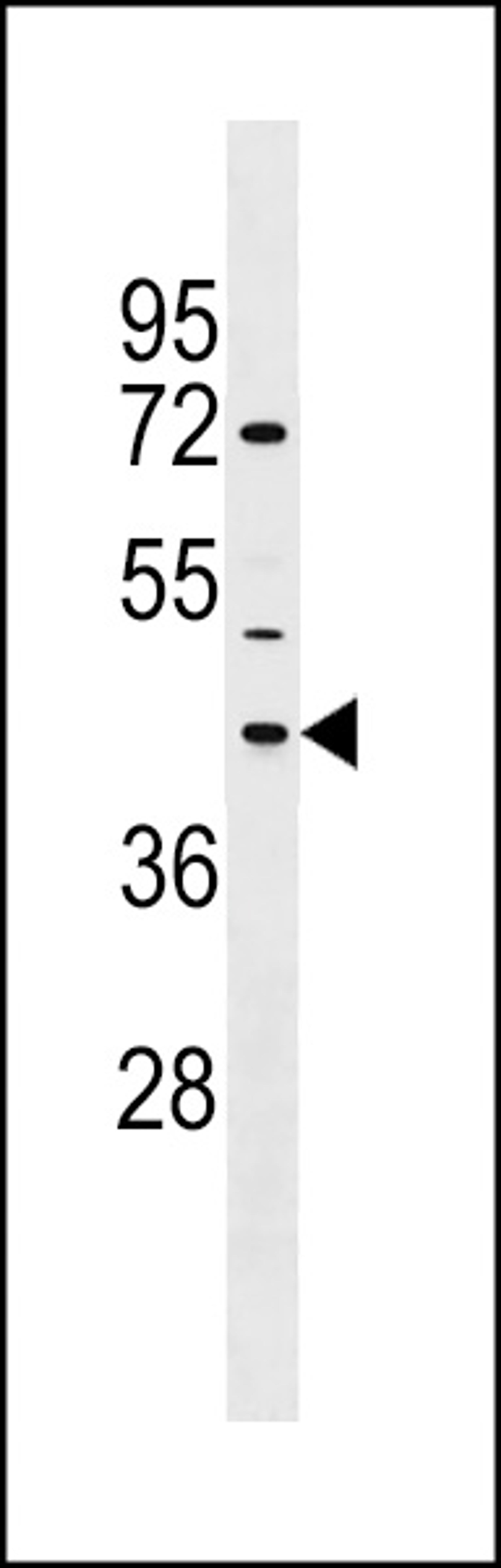 Western blot analysis in NCI-H292 cell line lysates (35ug/lane).