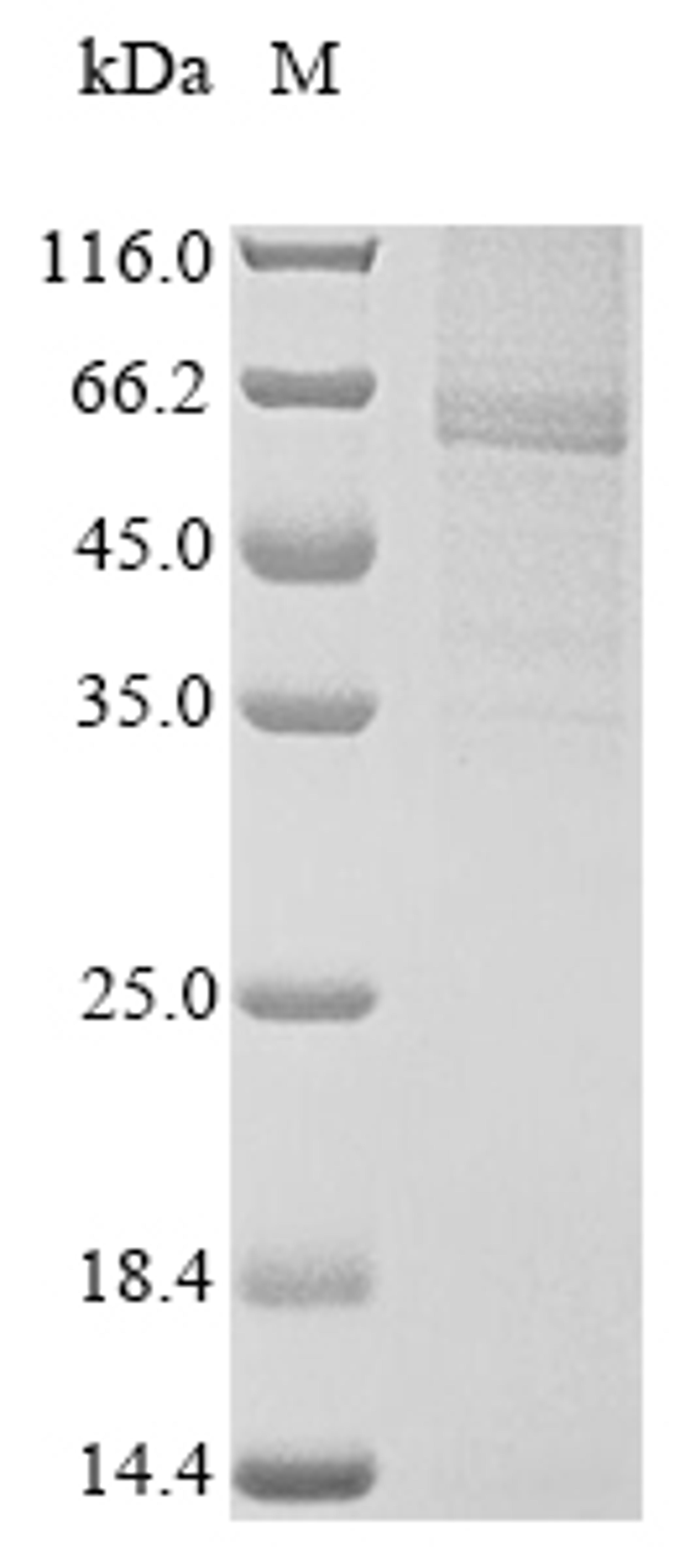 (Tris-Glycine gel) Discontinuous SDS-PAGE (reduced) with 5% enrichment gel and 15% separation gel.