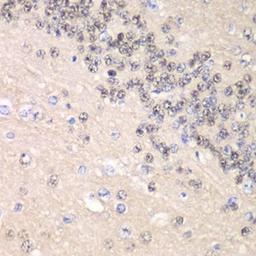 Immunohistochemical staining of rat brain tissue using CCNC antibody