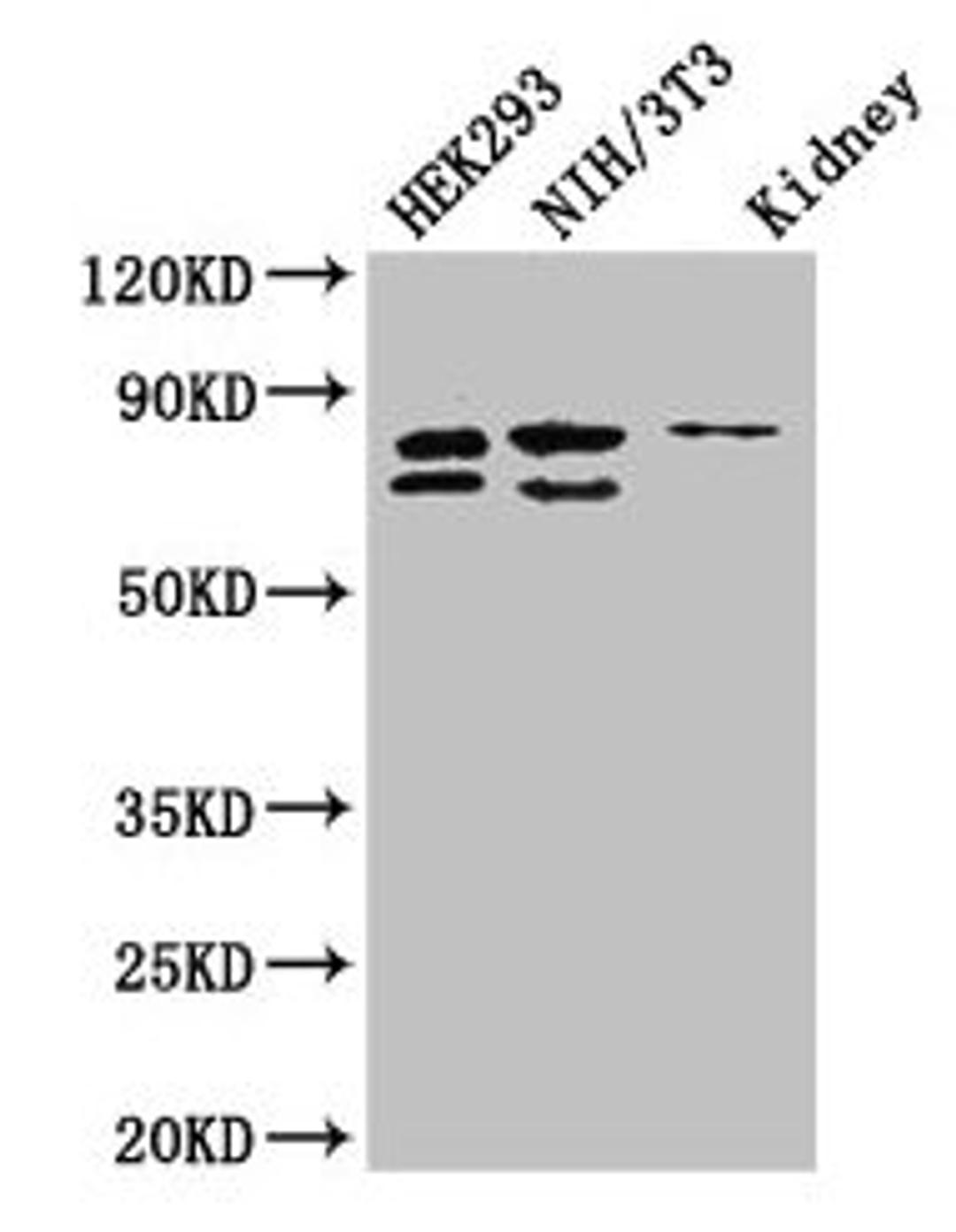 Western Blot. Positive WB detected in: HEK293 whole cell lysate, NIH/3T3 whole cell lysate, Mouse kidney tissue. All lanes: NUP85 antibody at 2.7ug/ml. Secondary. Goat polyclonal to rabbit IgG at 1/50000 dilution. Predicted band size: 76, 53, 70 kDa. Observed band size: 76, 70 kDa. 