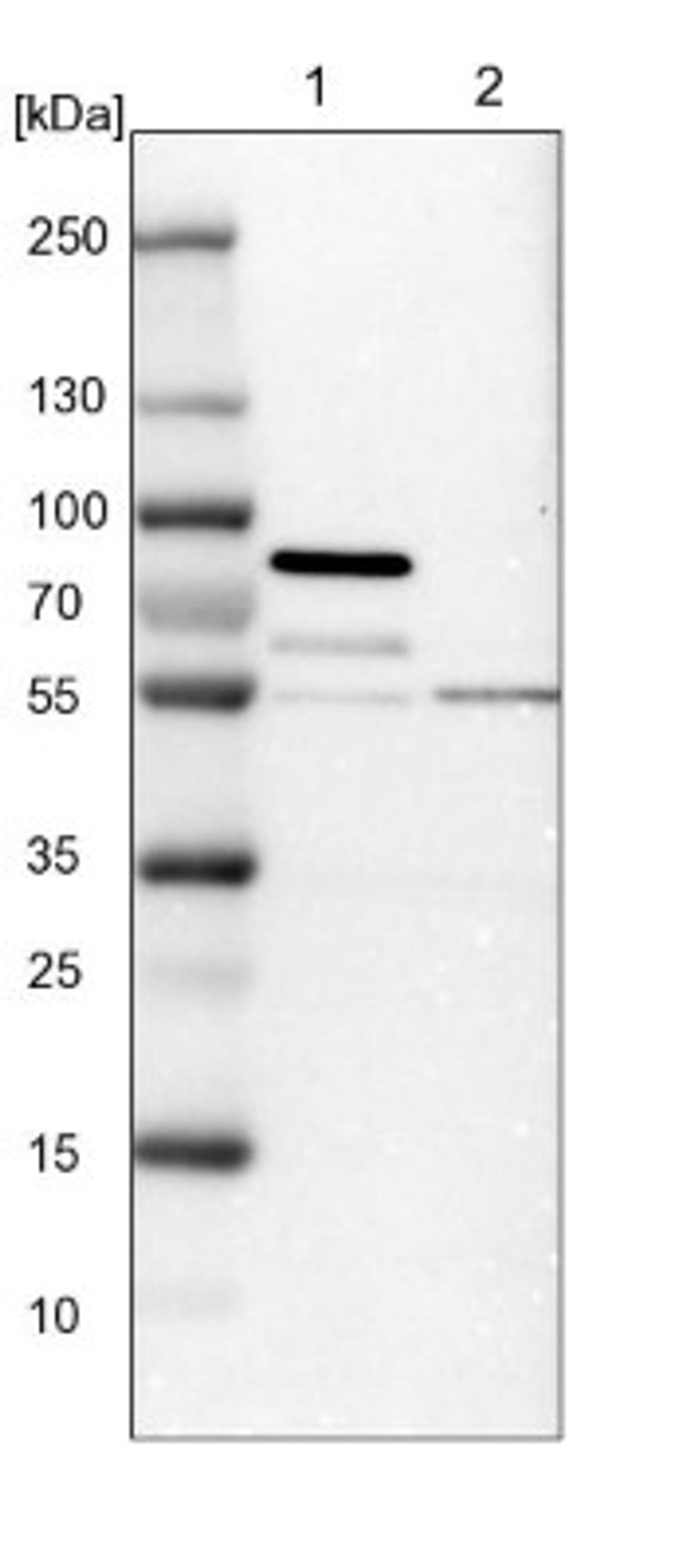 Western Blot: STAU2 Antibody [NBP1-89380] - Lane 1: NIH-3T3 cell lysate (Mouse embryonic fibroblast cells)<br/>Lane 2: NBT-II cell lysate (Rat Wistar bladder tumour cells)