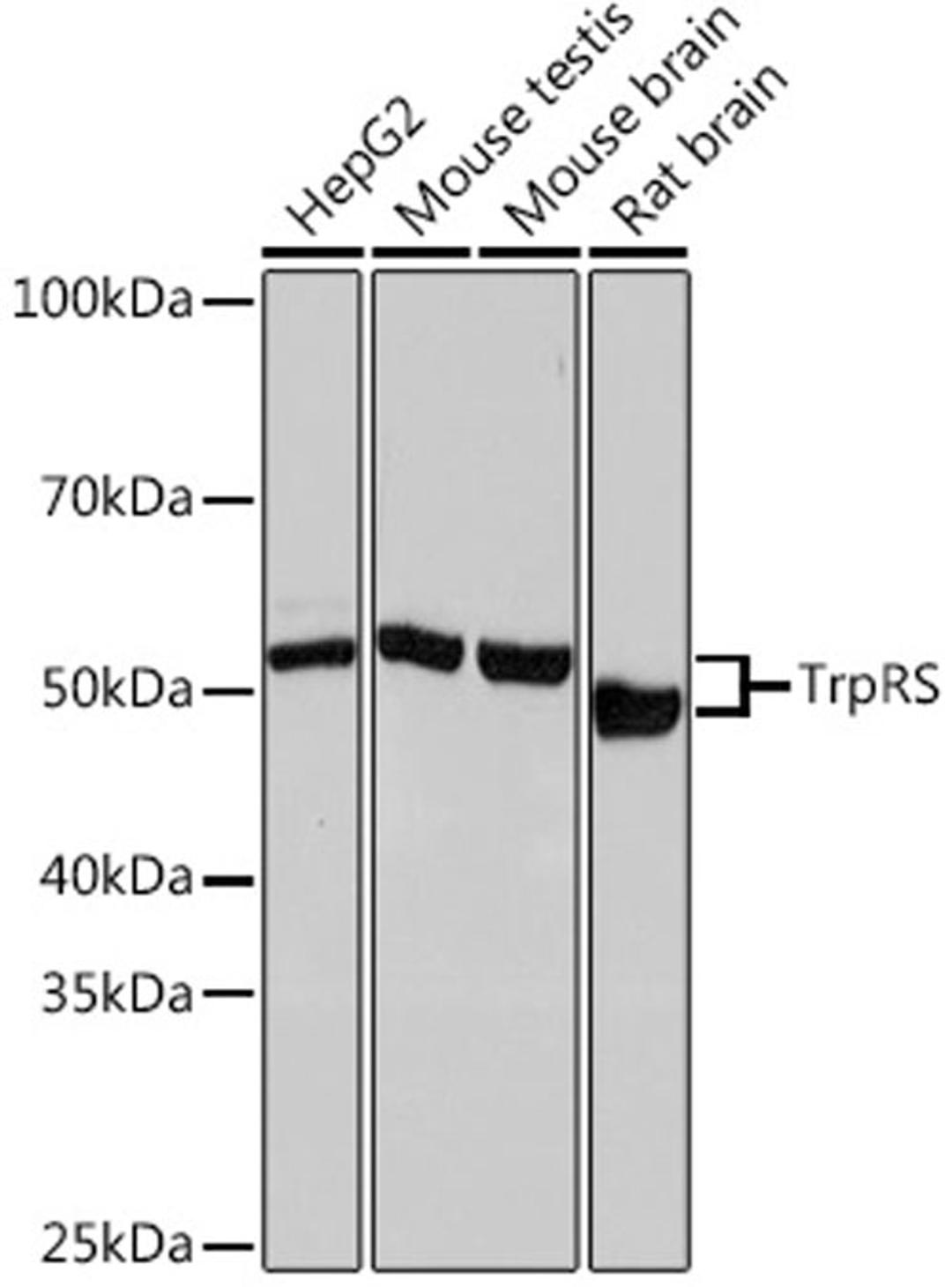 Western blot - TrpRS Rabbit mAb (A4469)