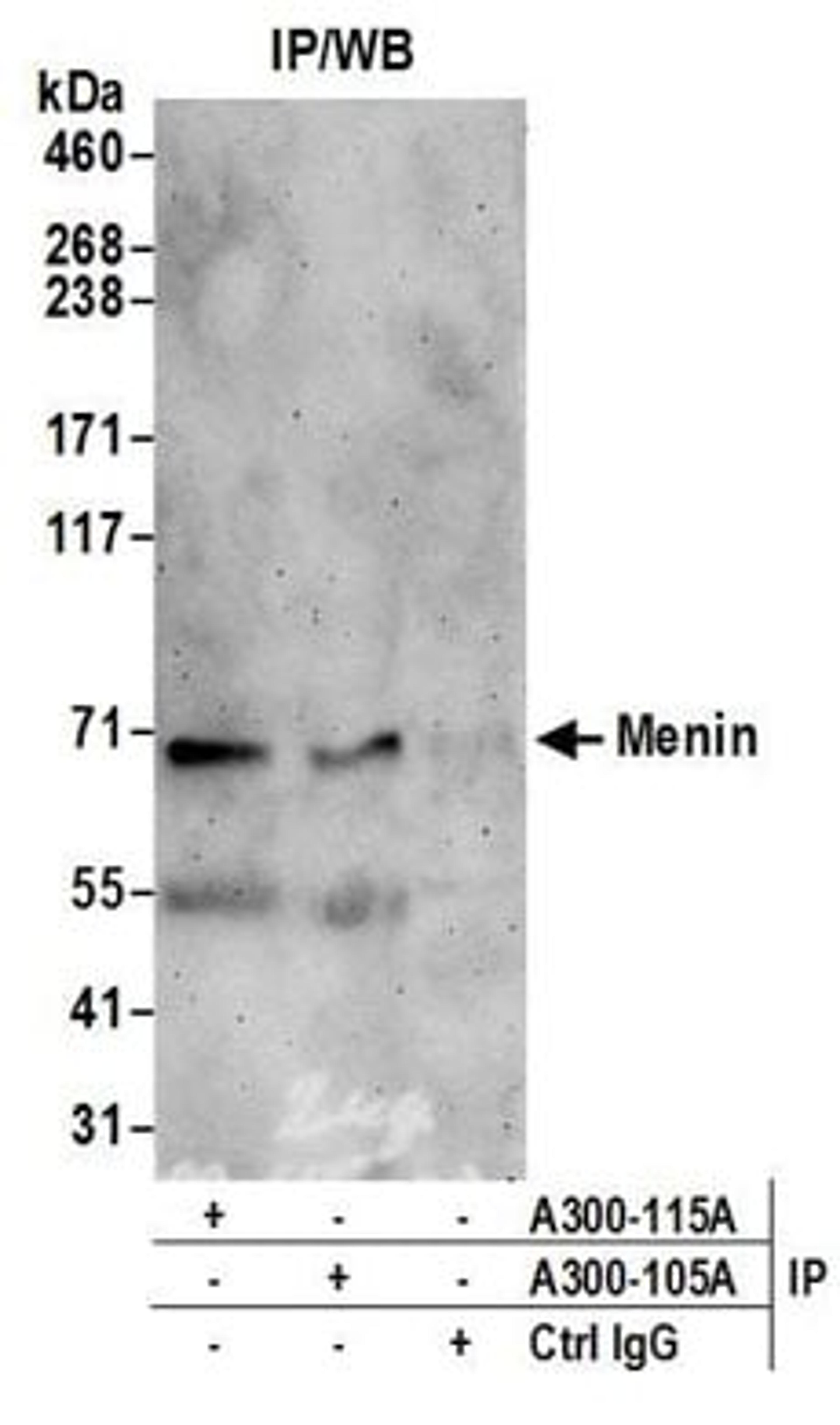 Detection of human Menin by western blot of immunoprecipitates.