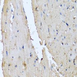 Immunohistochemical staining of rat heart tissue using DEFA1 antibody (dilution of 1:100)