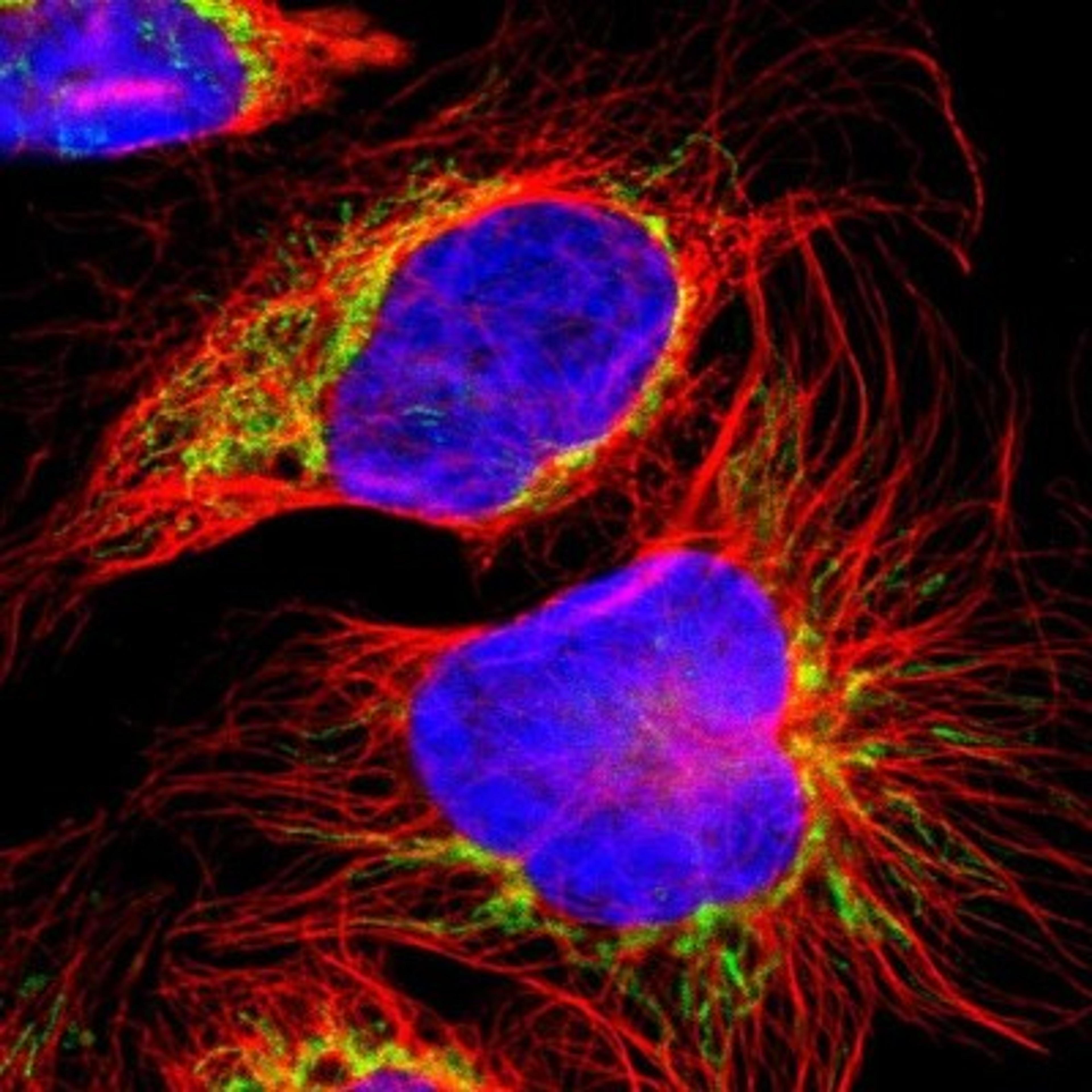 Immunocytochemistry/Immunofluorescence: TMX4 Antibody [NBP1-85159] - Staining of human cell line U-2 OS shows positivity in mitochondria.