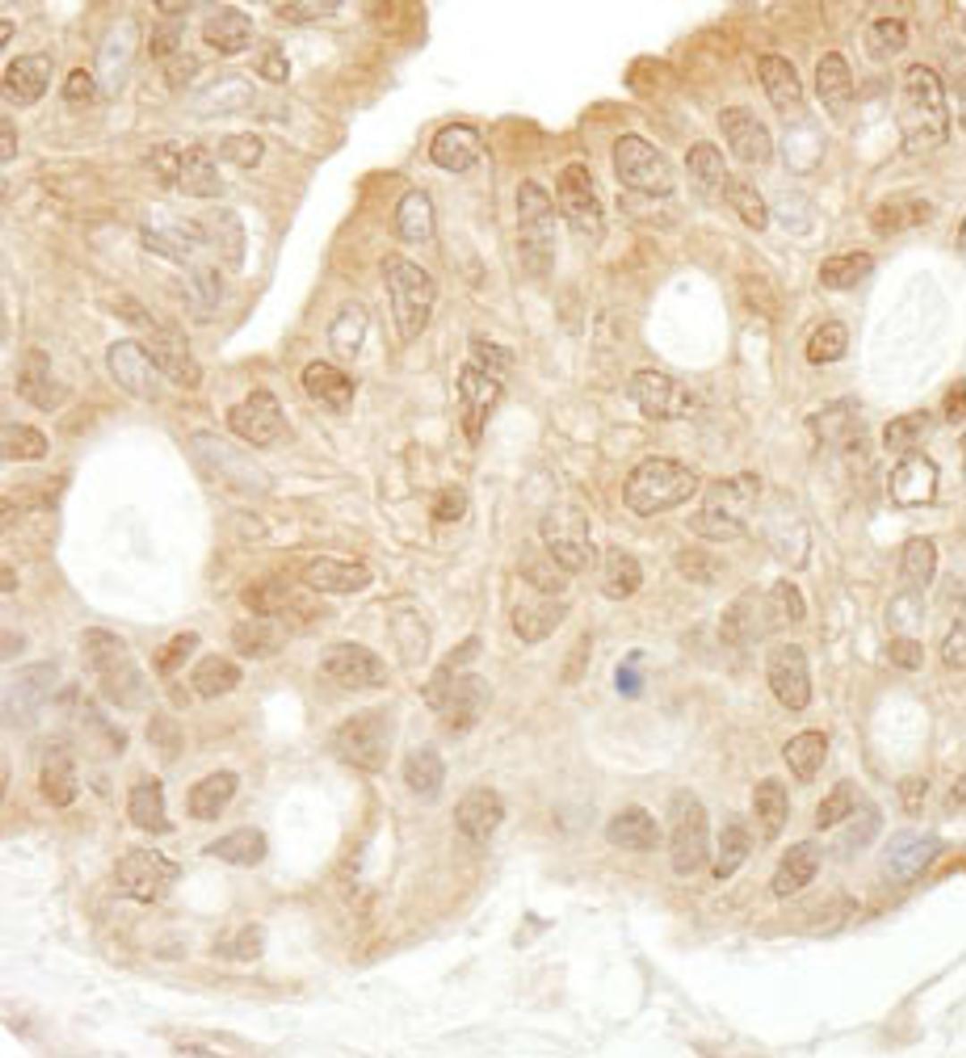 Detection of human SYK by immunohistochemistry.