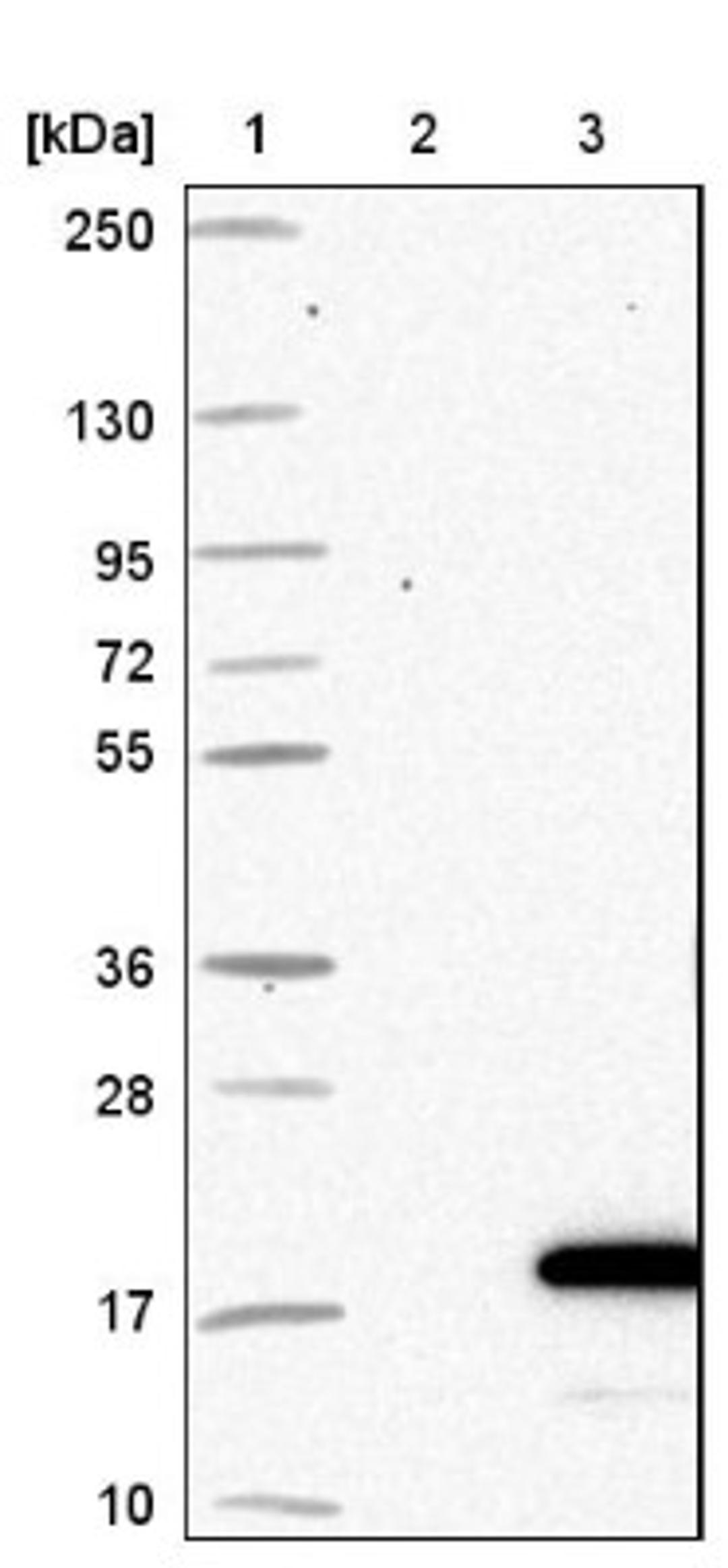 Western Blot: FDX1 Antibody [NBP1-89227] - Lane 1: Marker [kDa] 250, 130, 95, 72, 55, 36, 28, 17, 10<br/>Lane 2: Negative control (vector only transfected HEK293T lysate)<br/>Lane 3: Over-expression lysate (Co-expressed with a C-terminal myc-DDK tag (~3.1 kDa) in mammalian HEK293T cells, LY401330)