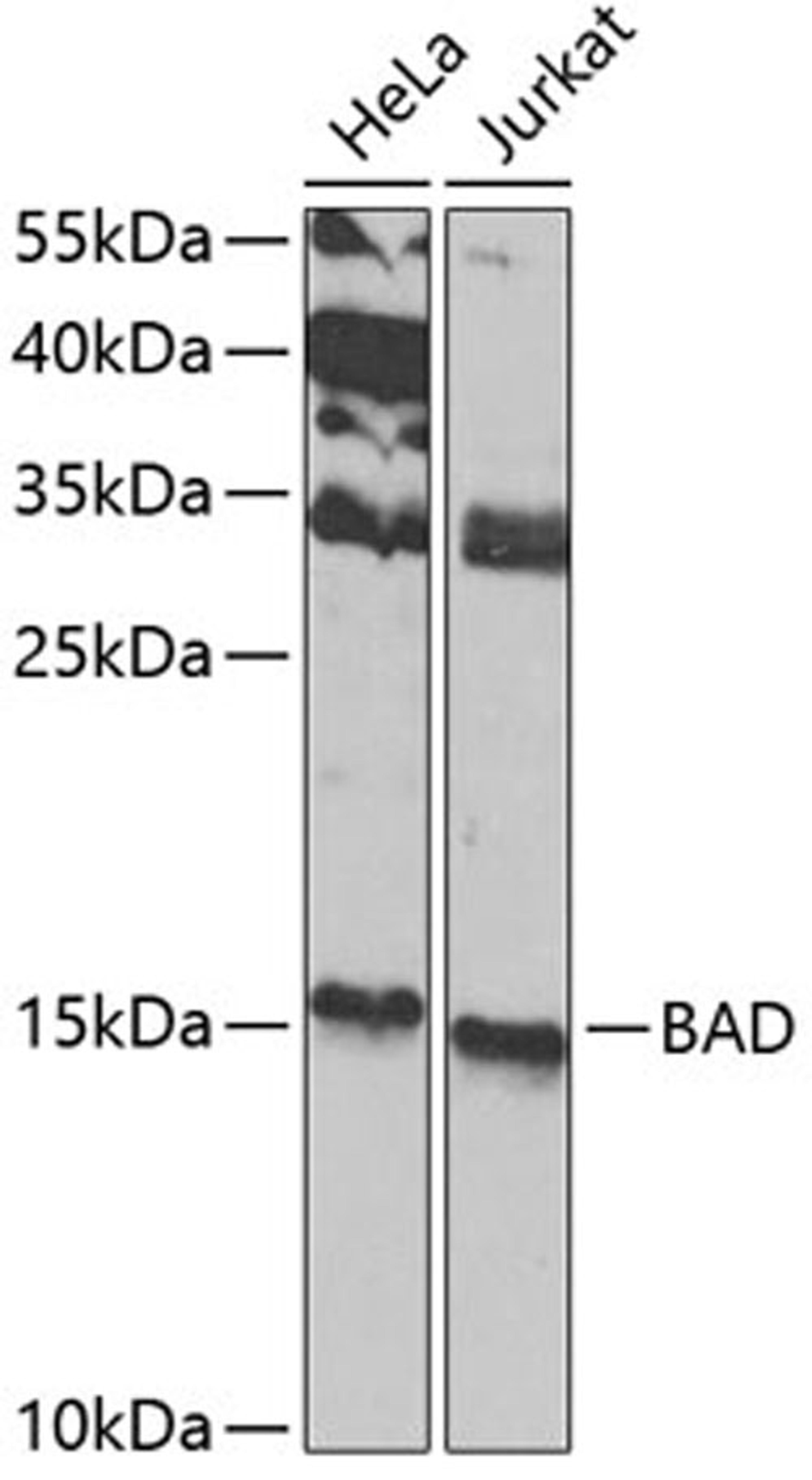 Western blot - BAD antibody (A1593)