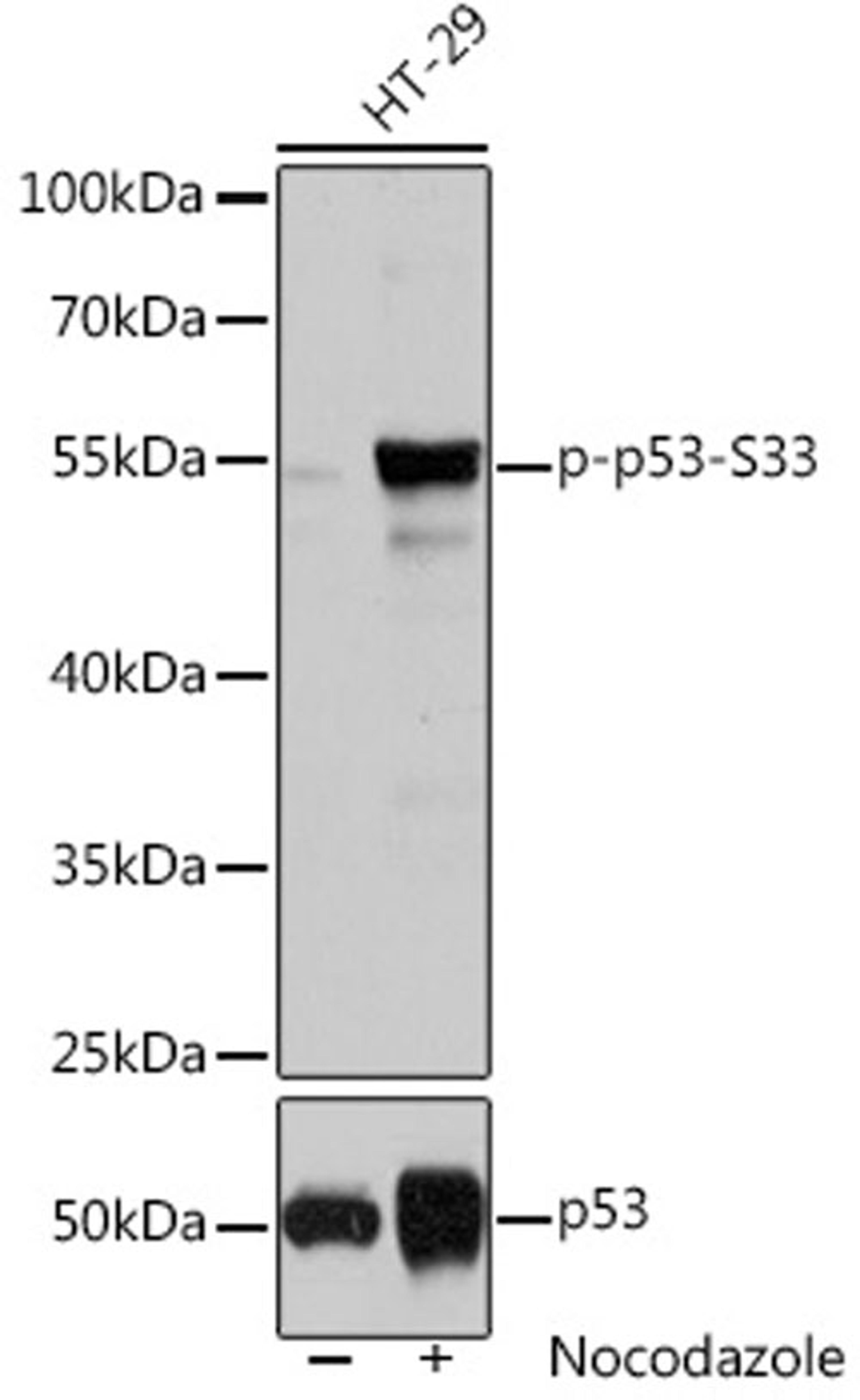 Western blot - Phospho-p53-S33 pAb (AP0762)