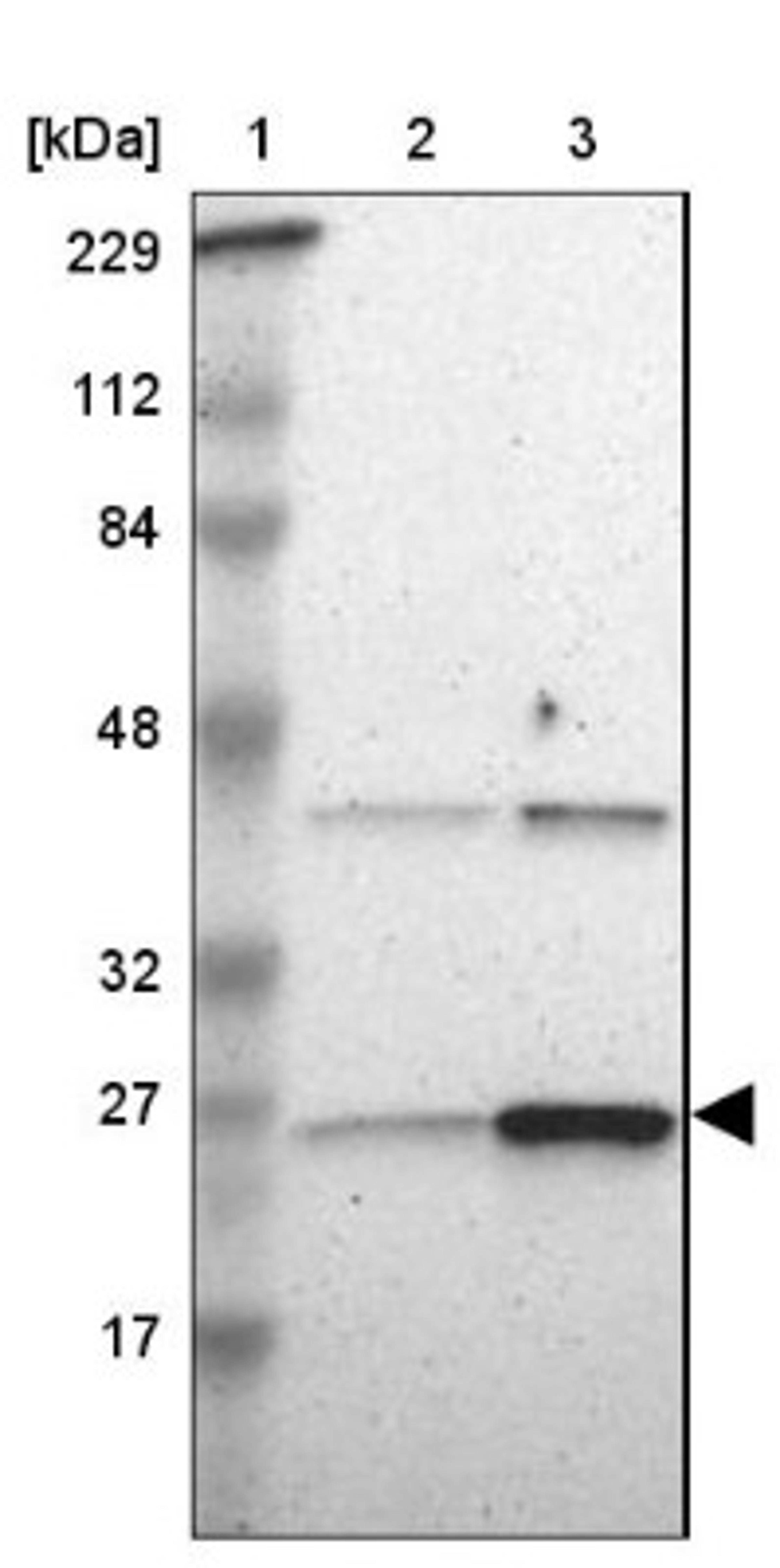 Western Blot: Adenylate Kinase 1 Antibody [NBP1-87401] - Lane 1: Marker [kDa] 229, 112, 84, 48, 32, 27, 17<br/>Lane 2: Human cell line RT-4<br/>Lane 3: Human cell line U-251MG sp