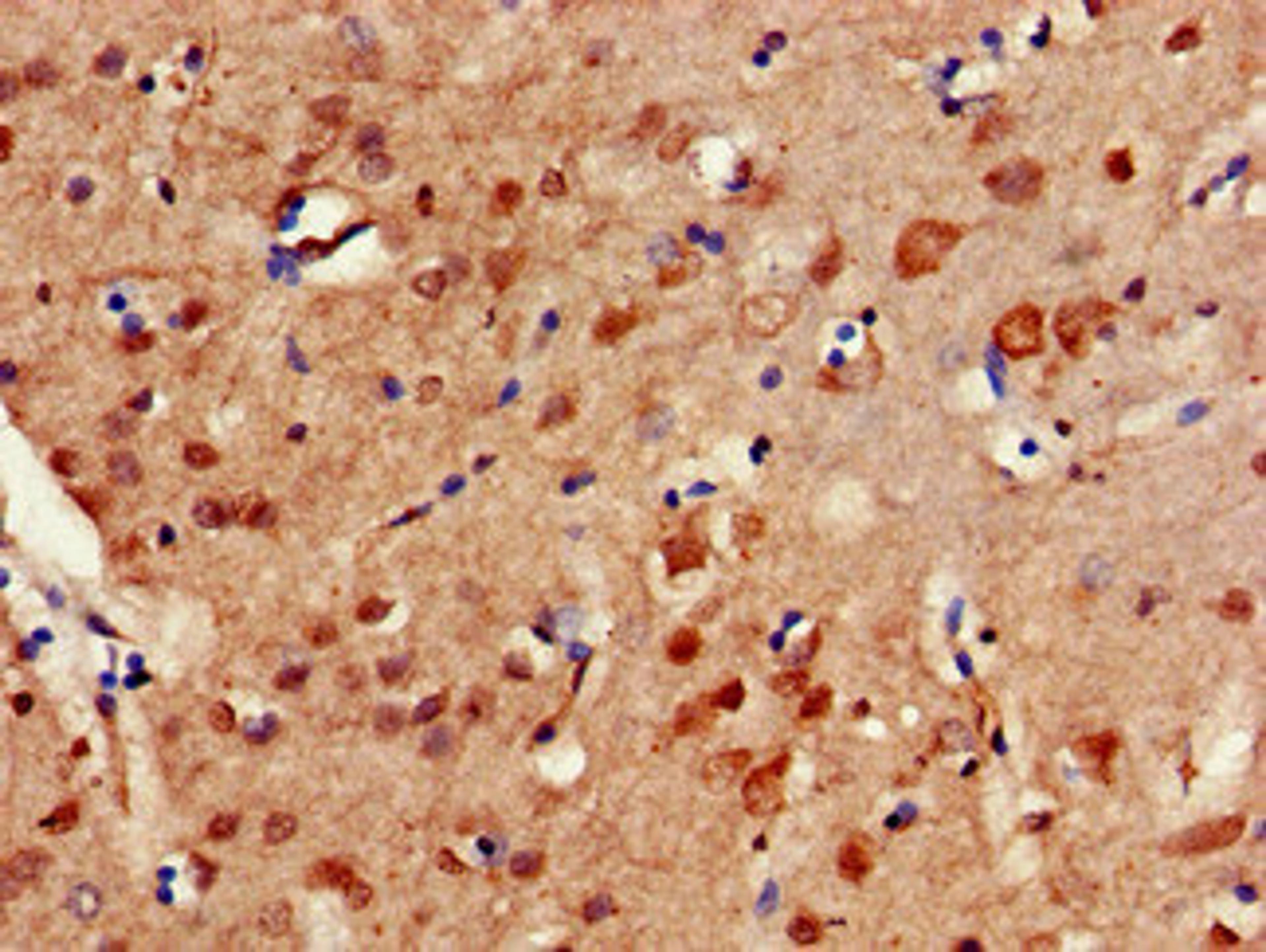 Immunohistochemistry of paraffin-embedded human brain tissue using CSB-PA849795HA01HU at dilution of 1:100