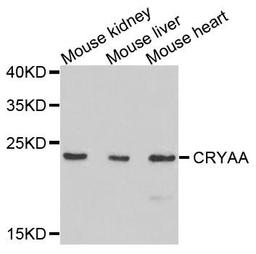 Western blot analysis of extracts of mouse tissues using CRYAA antibody