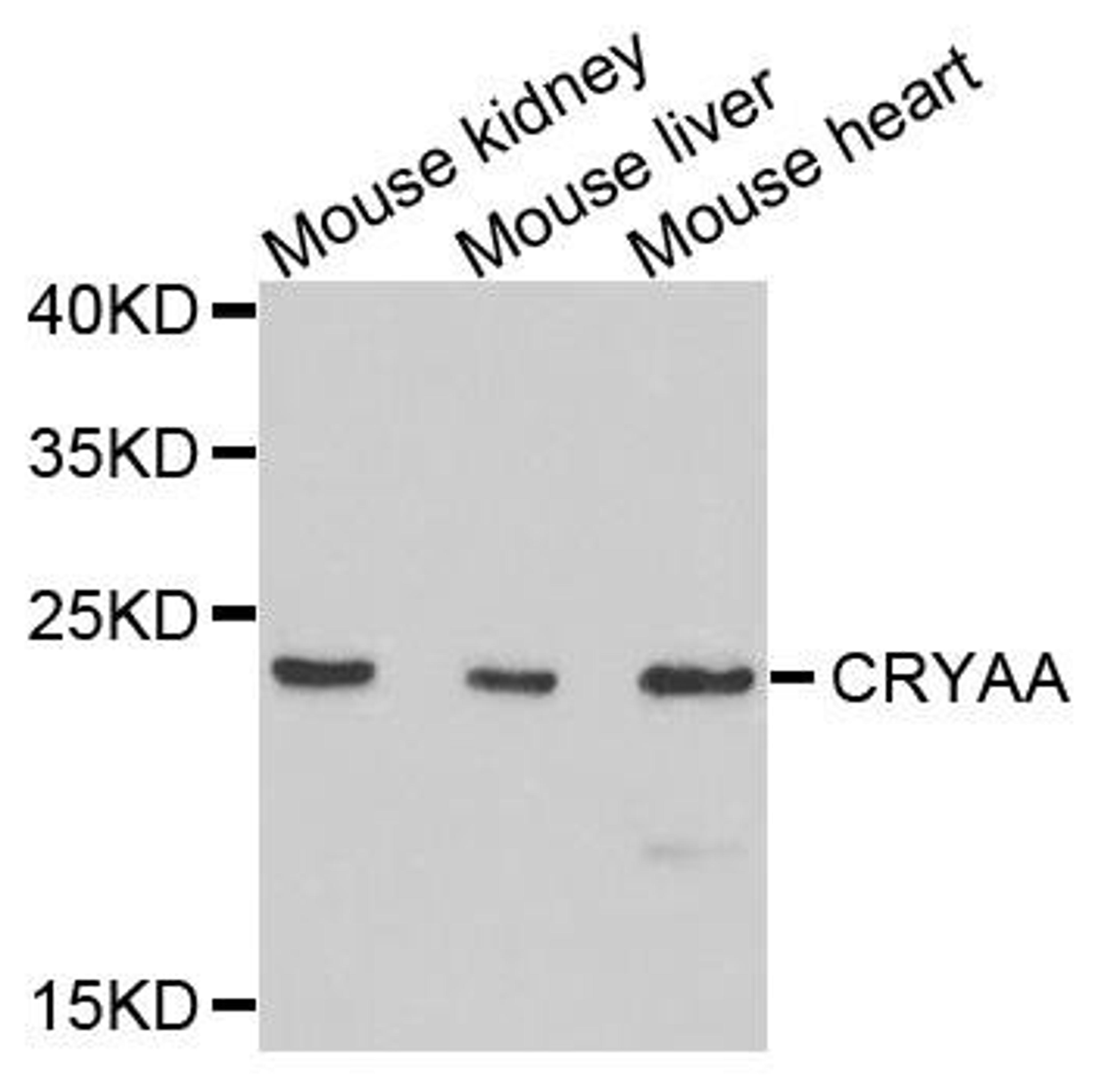 Western blot analysis of extracts of mouse tissues using CRYAA antibody