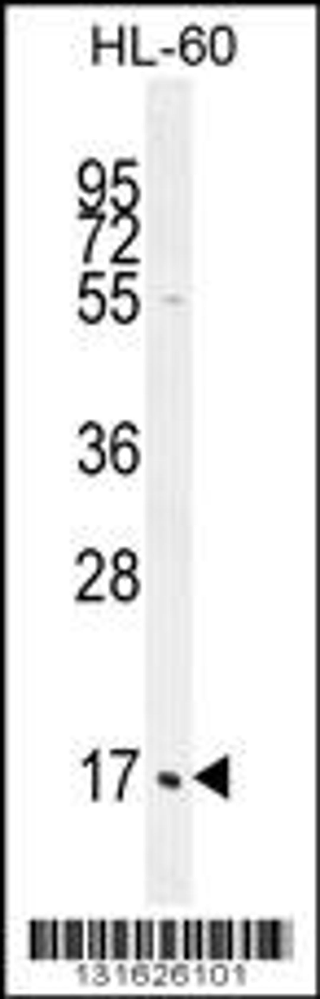 Western blot analysis in HL-60 cell line lysates (35ug/lane).