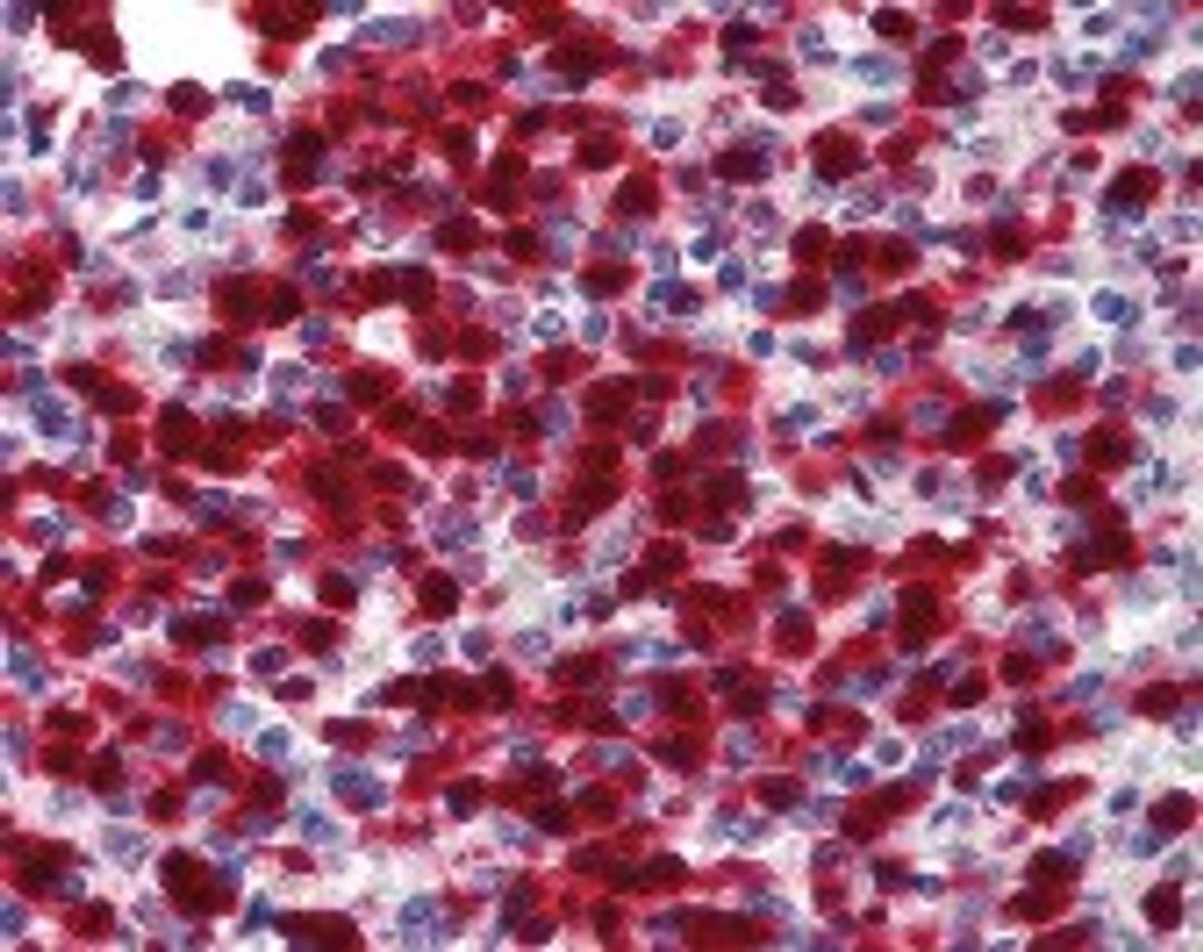 Immunohistochemistry staining of CDA in spleen (formalin-fixed paraffin embedded) tissue using CDA Antibody.