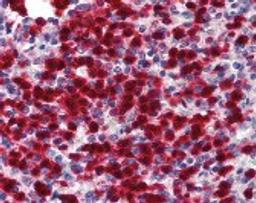 Immunohistochemistry staining of CDA in spleen (formalin-fixed paraffin embedded) tissue using CDA Antibody.