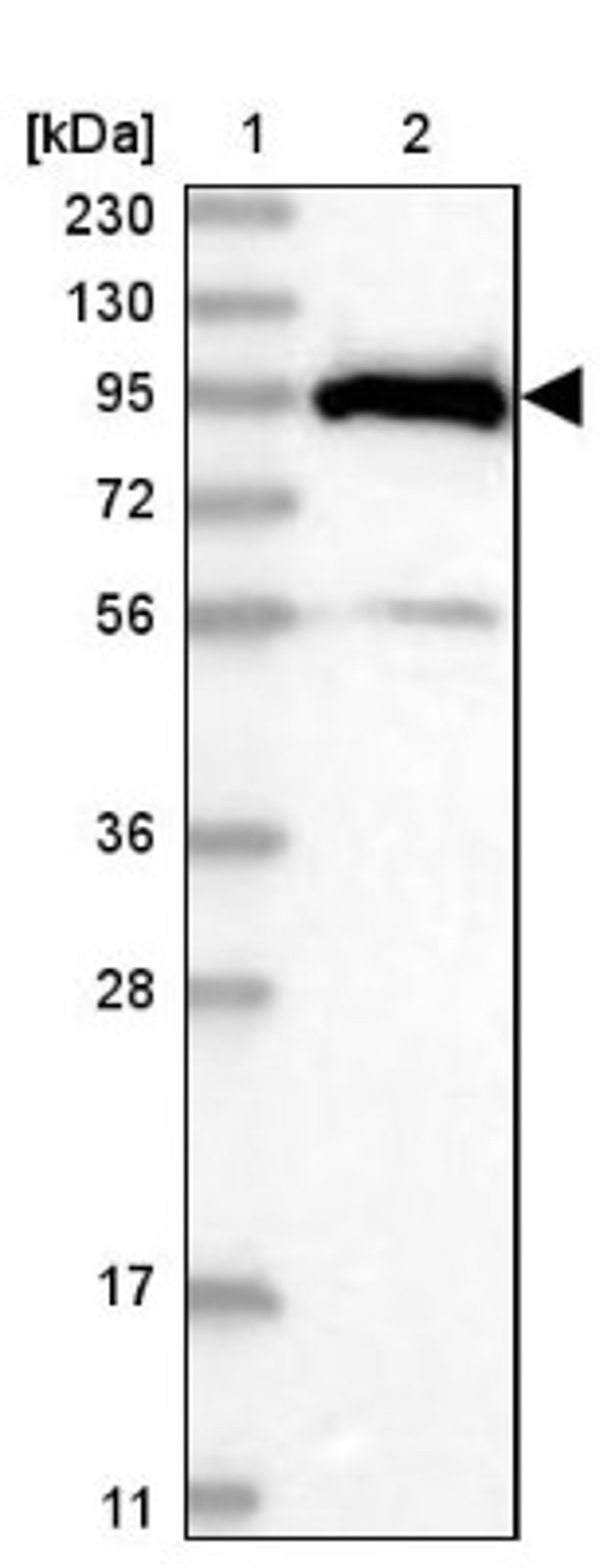 Western Blot: DDX21 Antibody [NBP1-83310] - Lane 1: Marker [kDa] 230, 130, 95, 72, 56, 36, 28, 17, 11<br/>Lane 2: Human cell line RT-4