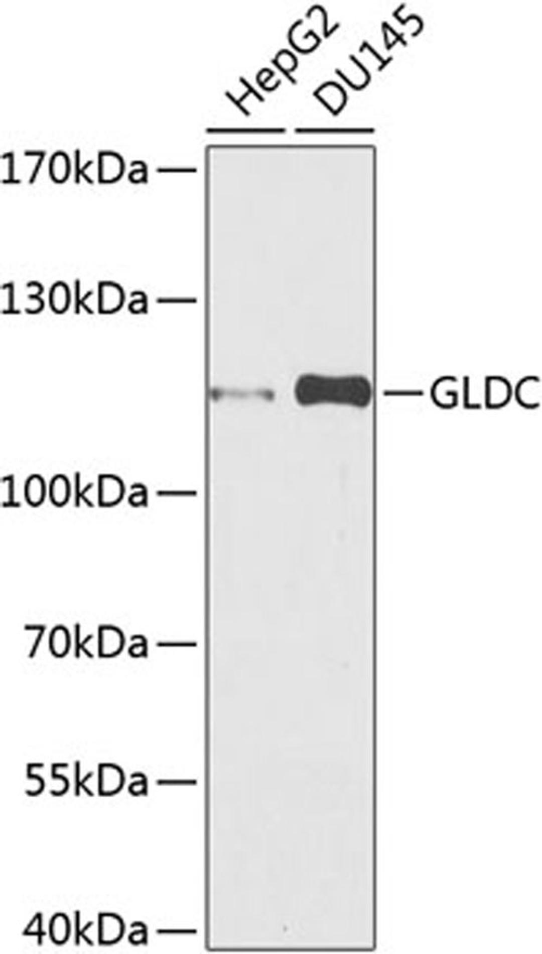 Western blot - GLDC antibody (A9933)