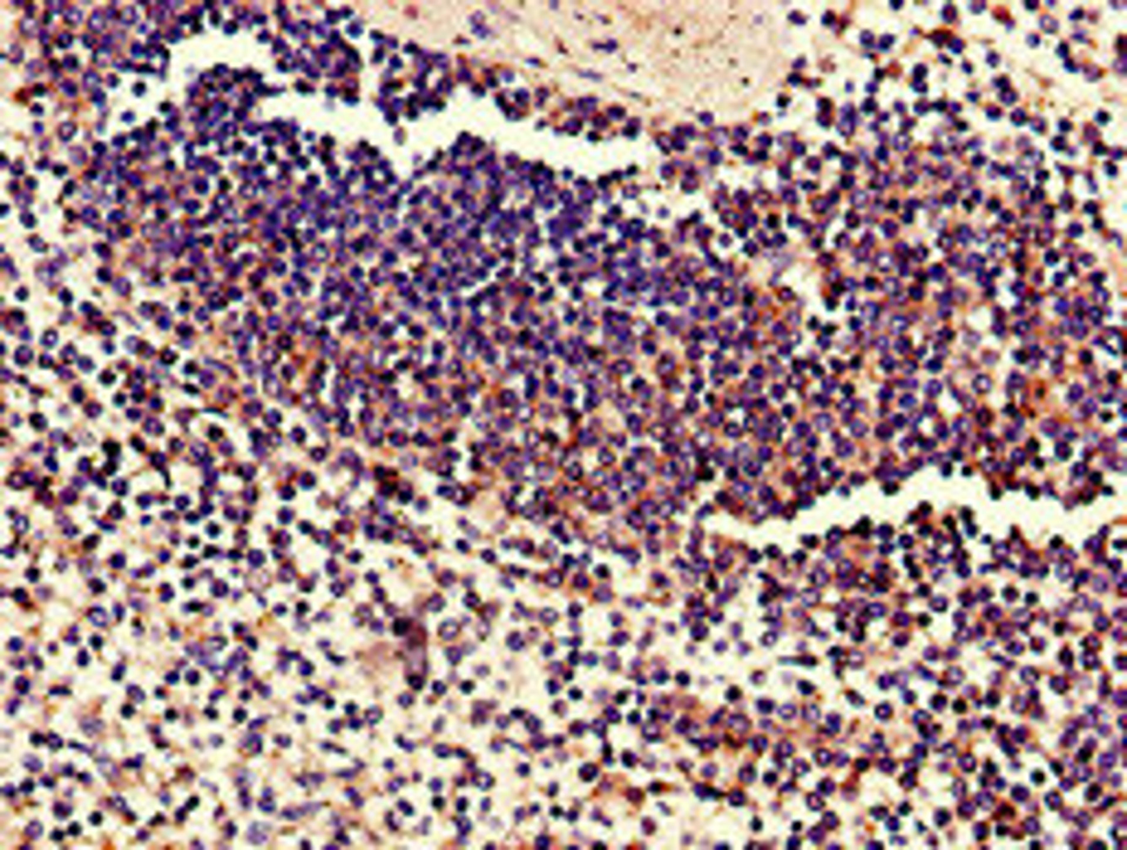 Immunohistochemistry of paraffin-embedded human spleen tissue using CSB-PA847630LA01HU at dilution of 1:100