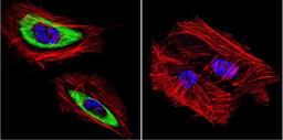 Immunocytochemistry/Immunofluorescence: Cytohesin 2 Antibody (10A12) [NBP2-22514] - Analysis of Cytohesin 2 in HeLa Cells. Cells were grown on chamber slides and fixed with formaldehyde prior to staining. Cells were probed without (control) or with a Cytohesin 2 monoclonal antibody at a dilution of 1:100 overnight at 4C, washed with PBS and incubated with a DyLight-488 conjugated secondary antibody. Cytohesin 2 staining (green), F-Actin staining with Phalloidin (red) and nuclei with DAPI (blue) is shown.