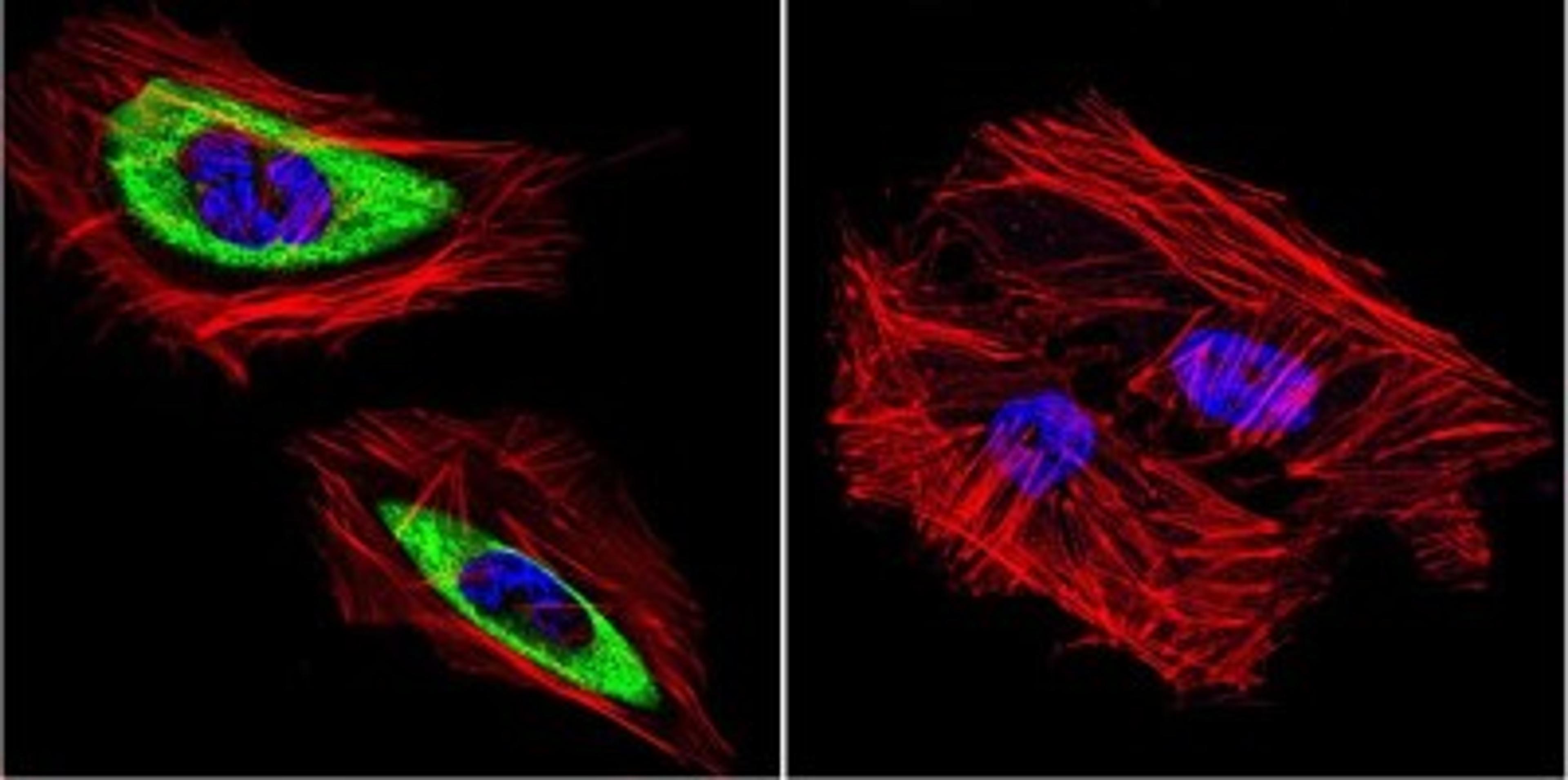 Immunocytochemistry/Immunofluorescence: Cytohesin 2 Antibody (10A12) [NBP2-22514] - Analysis of Cytohesin 2 in HeLa Cells. Cells were grown on chamber slides and fixed with formaldehyde prior to staining. Cells were probed without (control) or with a Cytohesin 2 monoclonal antibody at a dilution of 1:100 overnight at 4C, washed with PBS and incubated with a DyLight-488 conjugated secondary antibody. Cytohesin 2 staining (green), F-Actin staining with Phalloidin (red) and nuclei with DAPI (blue) is shown.