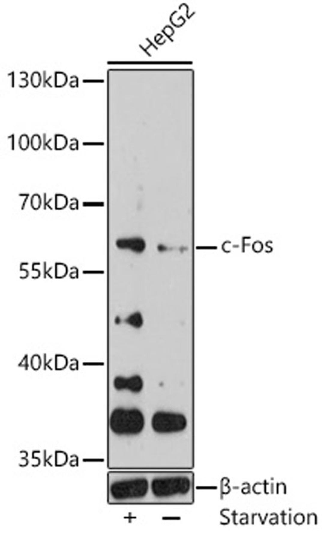 Western blot - c-Fos antibody (A0236)