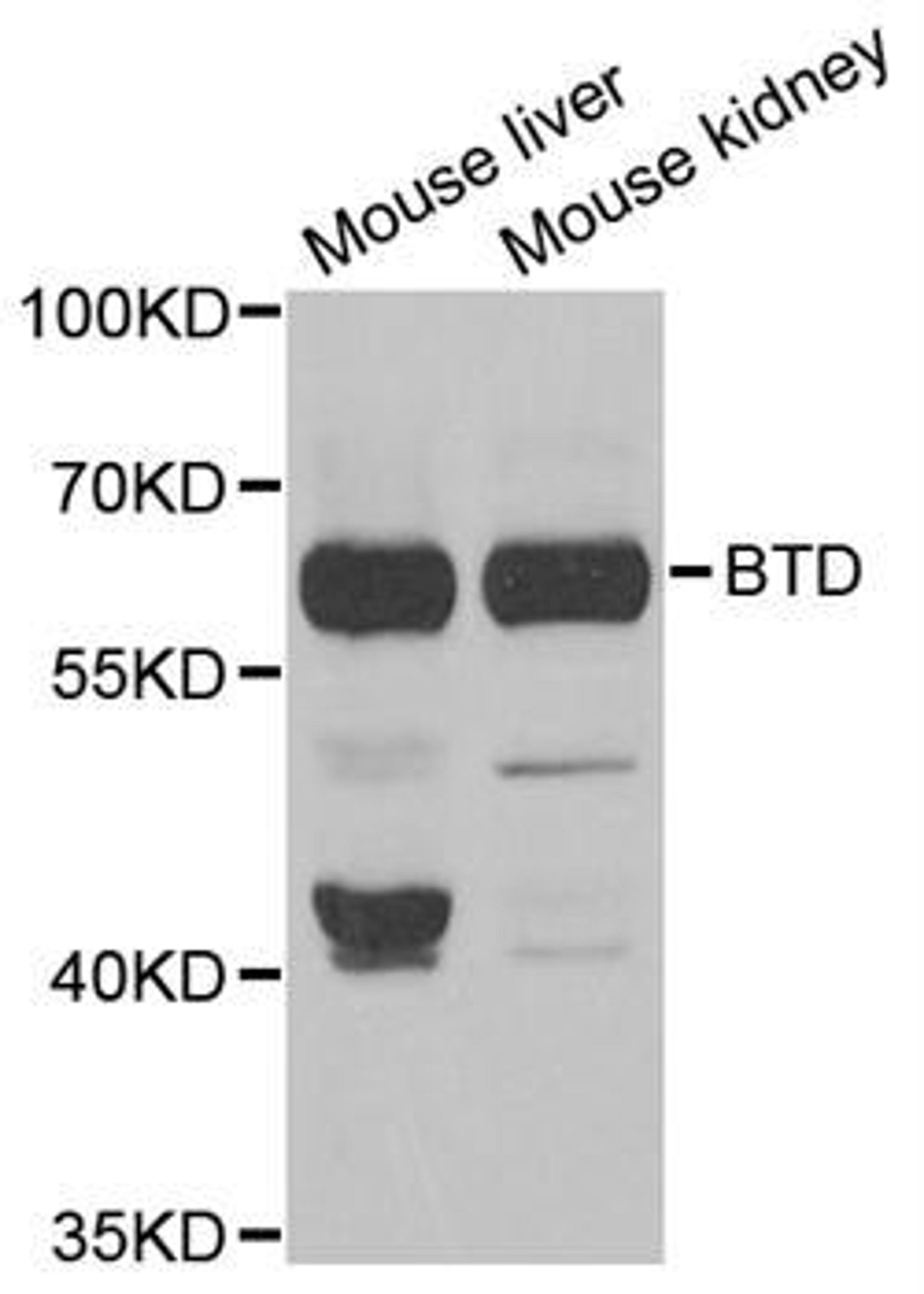 Western blot analysis of extracts of various tissues using BTD antibody