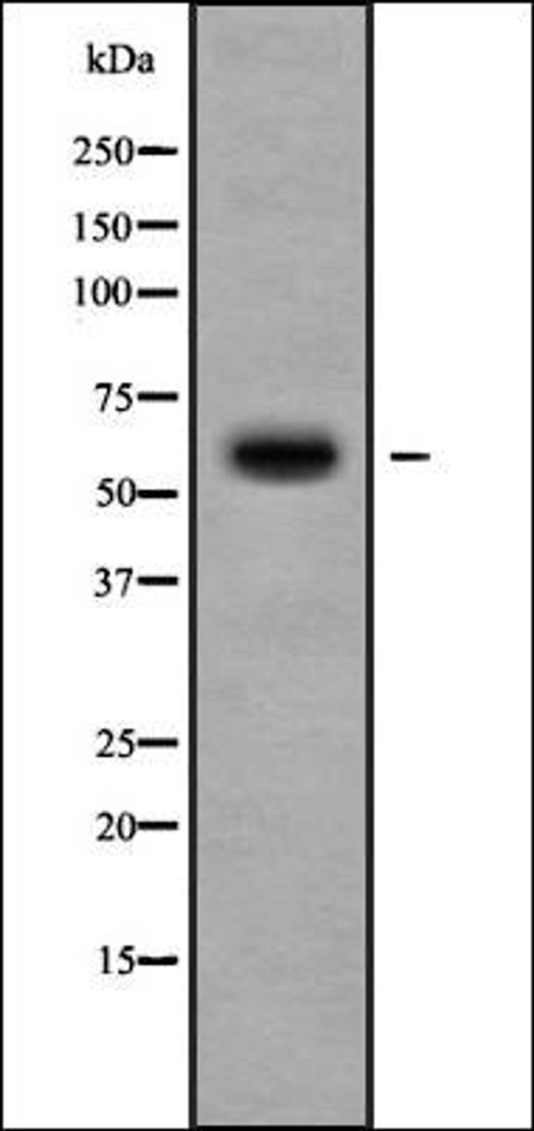 Western blot analysis of 293 whole cell lysates using Cytochrome P450 11B2 antibody