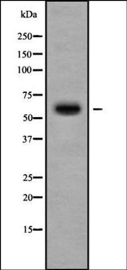 Western blot analysis of 293 whole cell lysates using Cytochrome P450 11B2 antibody