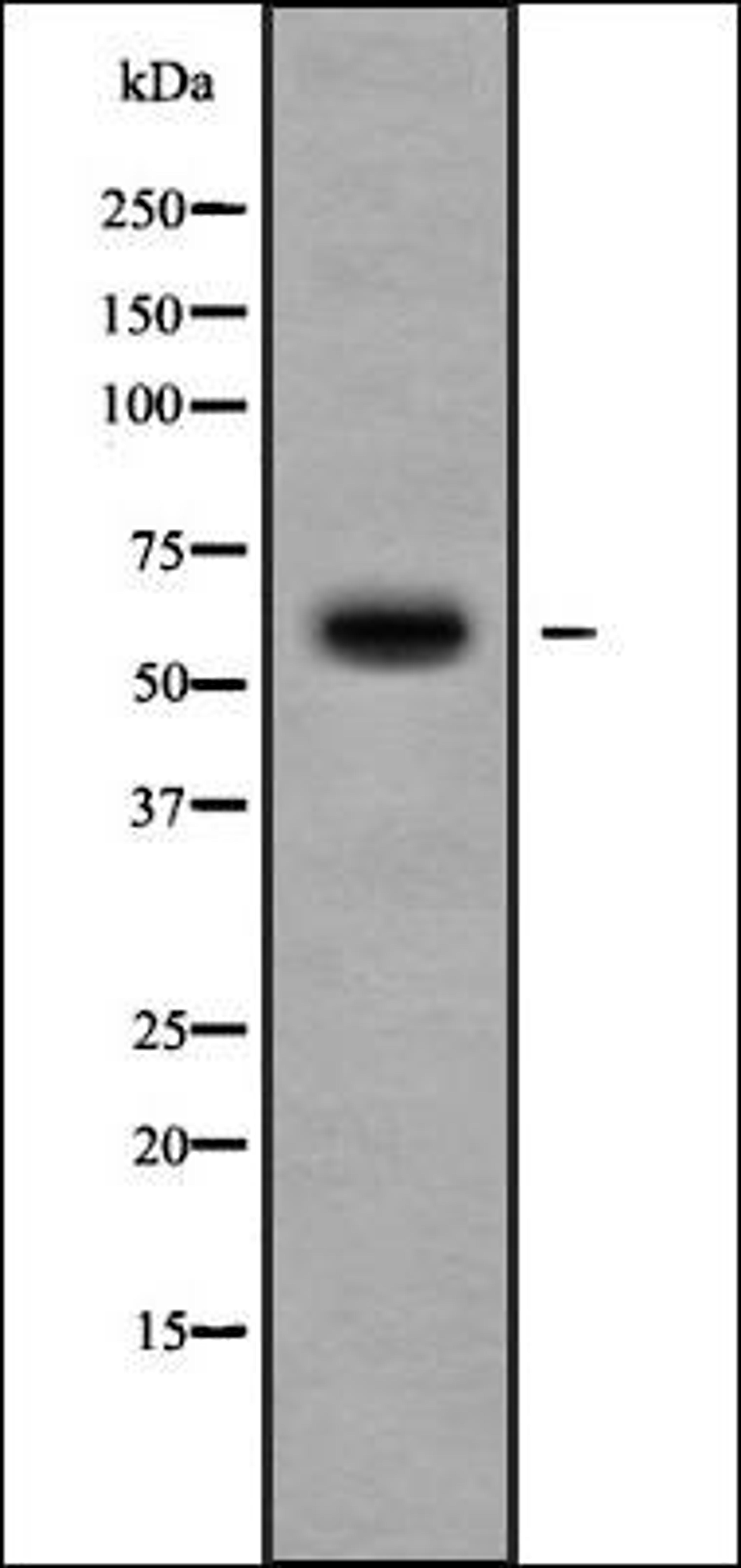 Western blot analysis of 293 whole cell lysates using Cytochrome P450 11B2 antibody