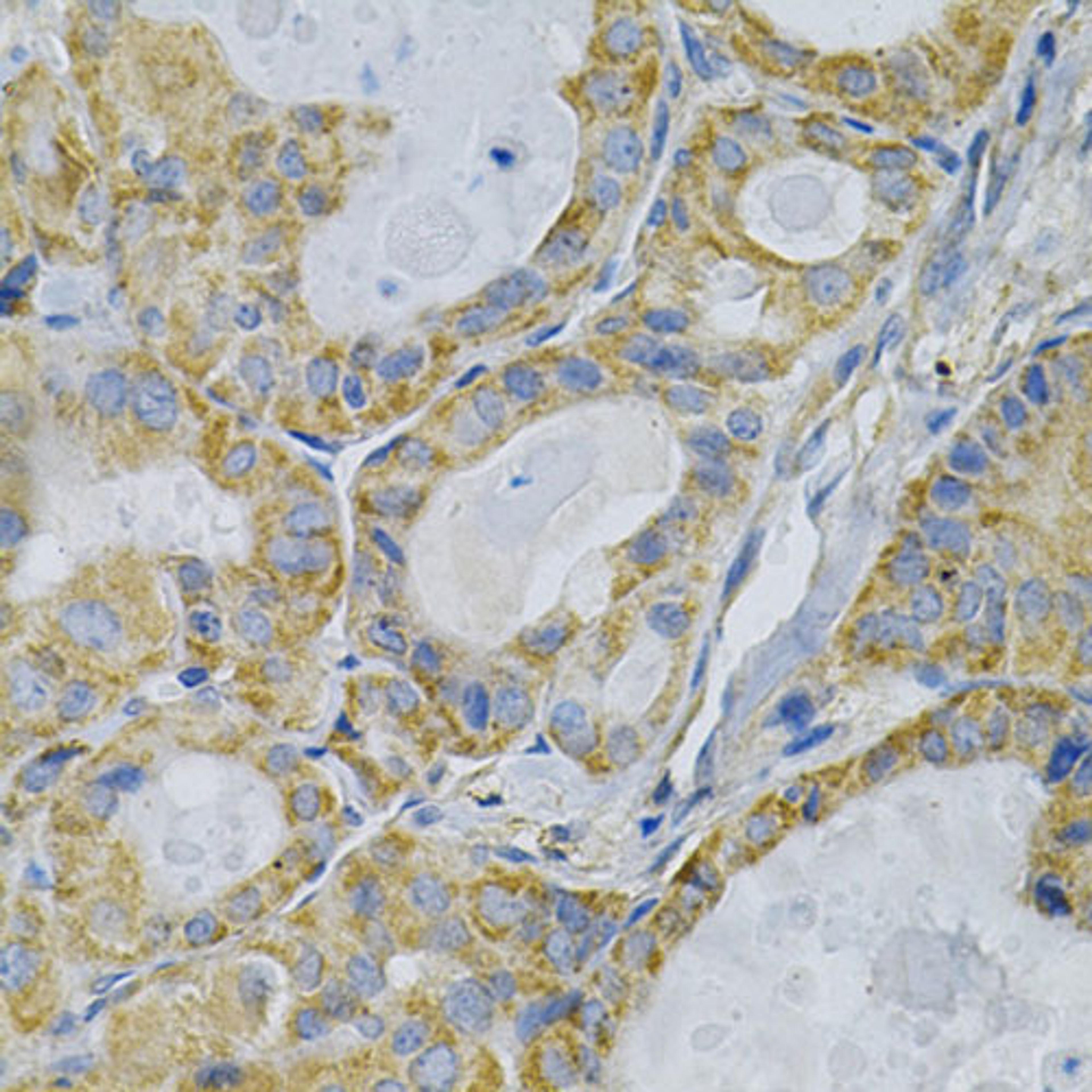 Immunohistochemistry  - TLR7 Antibody (A0991)