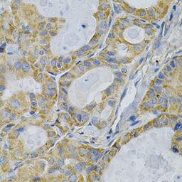 Immunohistochemistry - TLR7 Antibody (A0991)