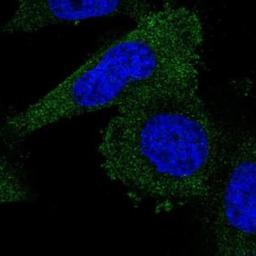 Immunocytochemistry/Immunofluorescence: Leupaxin Antibody [NBP2-31078] - Staining of human cell line U-251 MG shows positivity in cytoplasm.