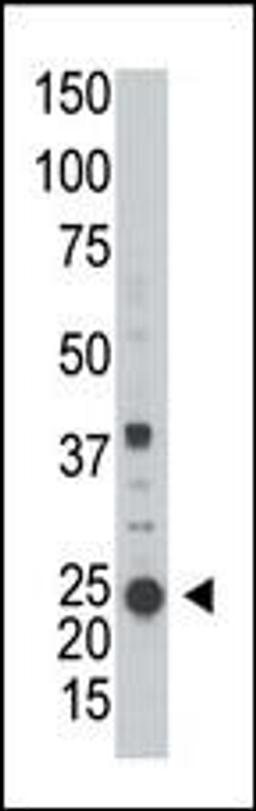 Western blot analysis of anti-ARL3 in A2058 cell line lysate (35ug/lane)