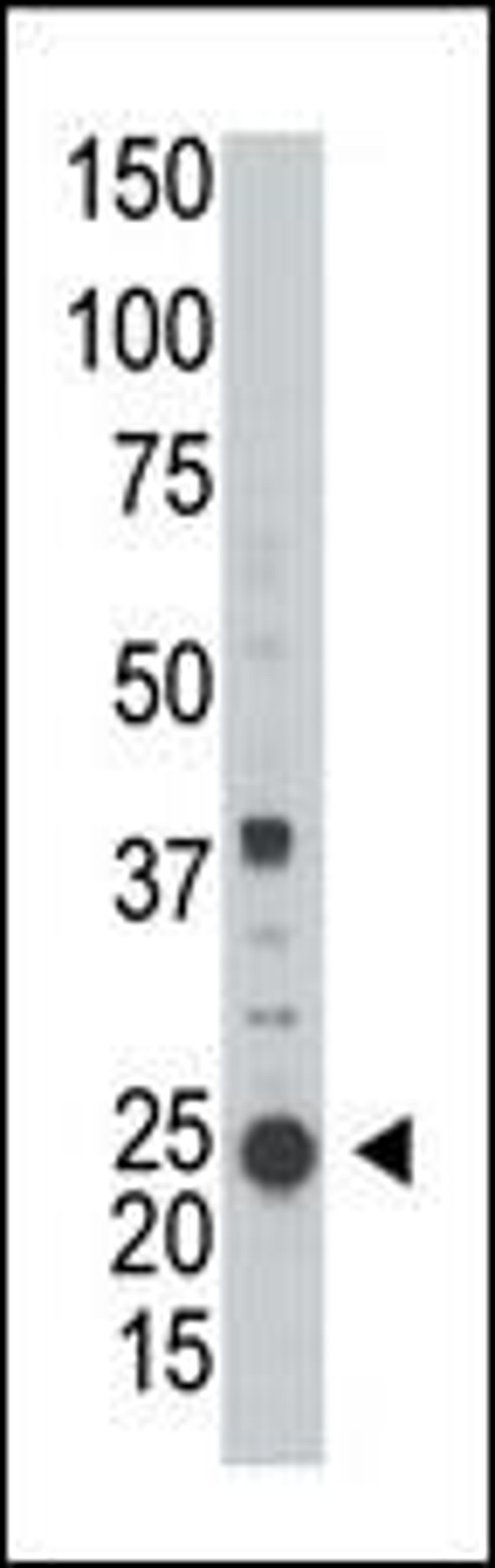 Western blot analysis of anti-ARL3 in A2058 cell line lysate (35ug/lane)