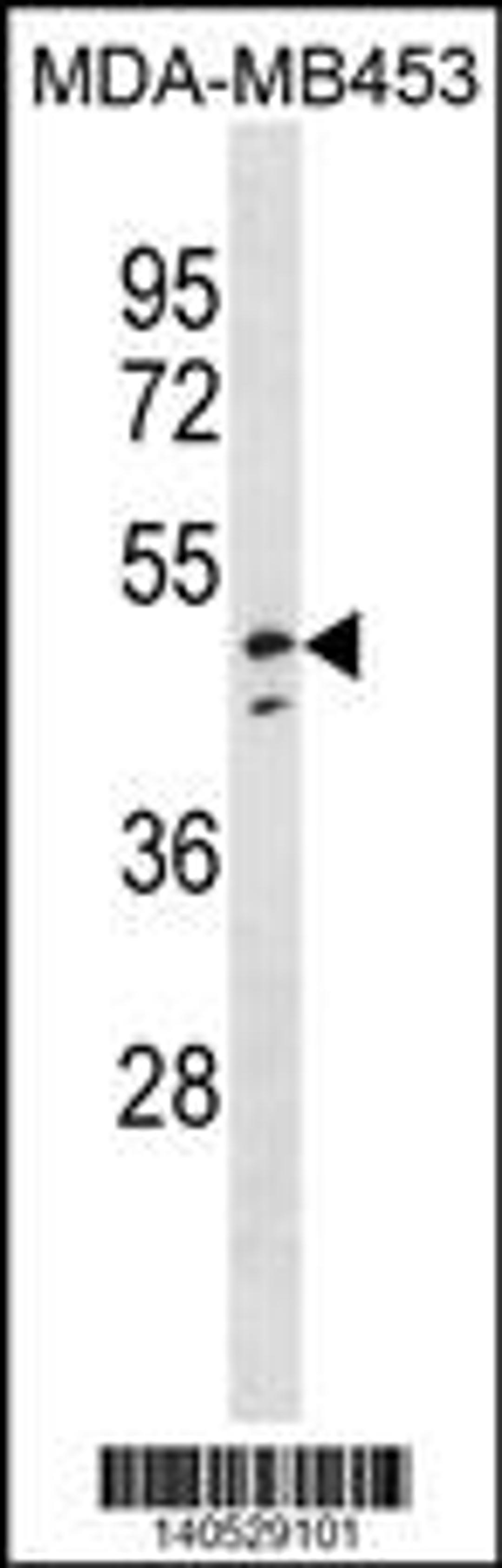 Western blot analysis in MDA-MB453 cell line lysates (35ug/lane).