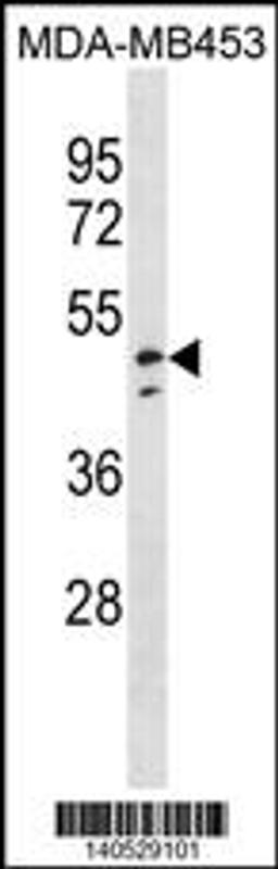 Western blot analysis in MDA-MB453 cell line lysates (35ug/lane).