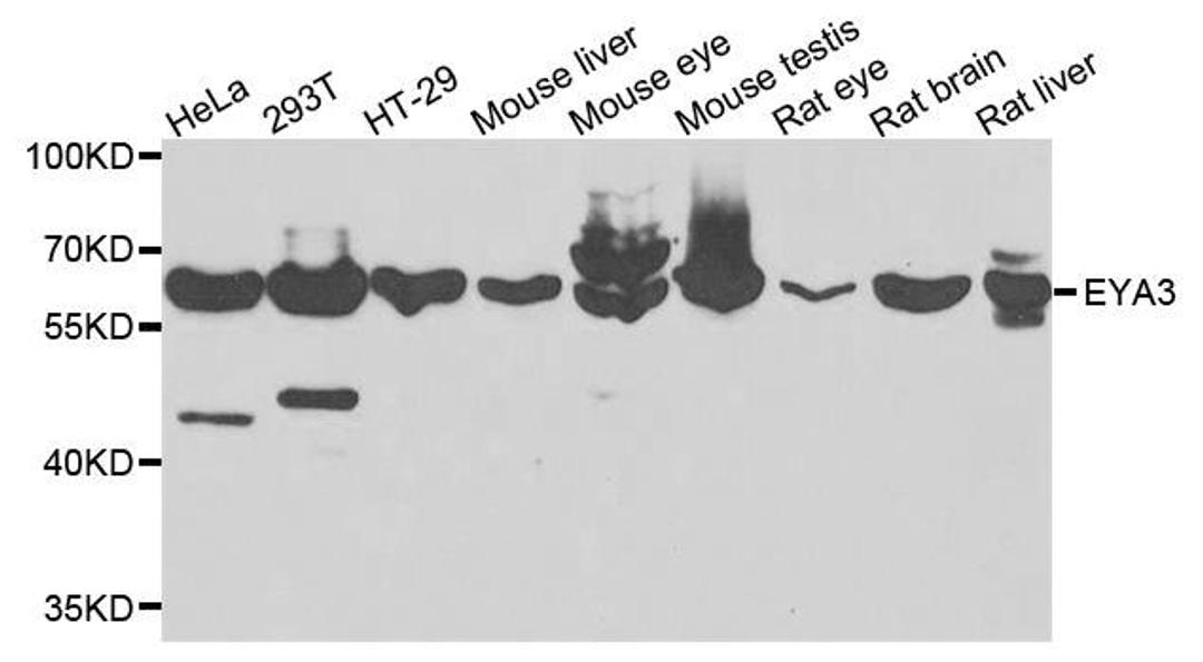 Western blot analysis of extracts of various cells using EYA3 antibody