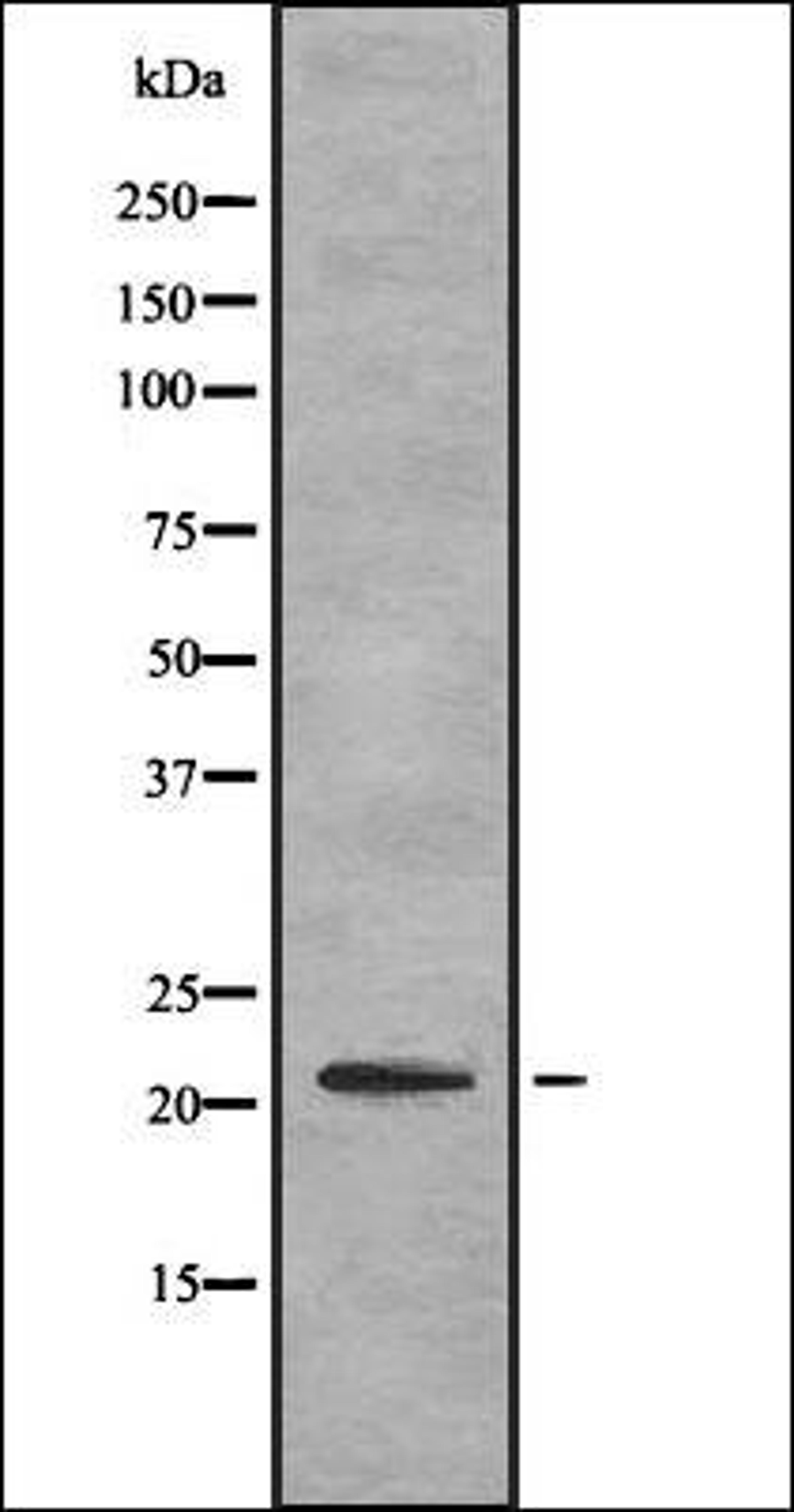 Western blot analysis of HEK293 cells using ITBP1 antibody