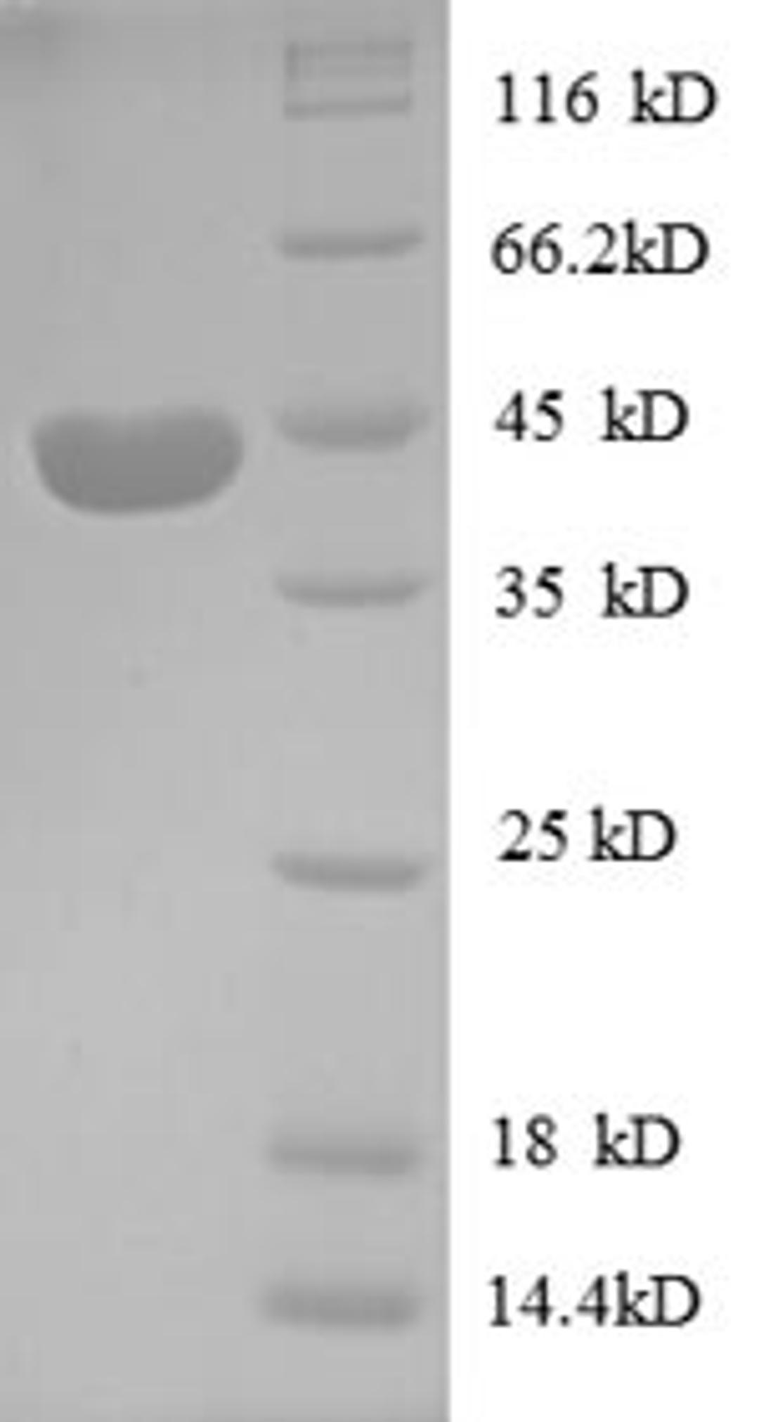 (Tris-Glycine gel) Discontinuous SDS-PAGE (reduced) with 5% enrichment gel and 15% separation gel.