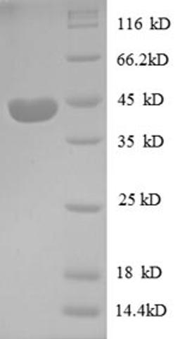 (Tris-Glycine gel) Discontinuous SDS-PAGE (reduced) with 5% enrichment gel and 15% separation gel.