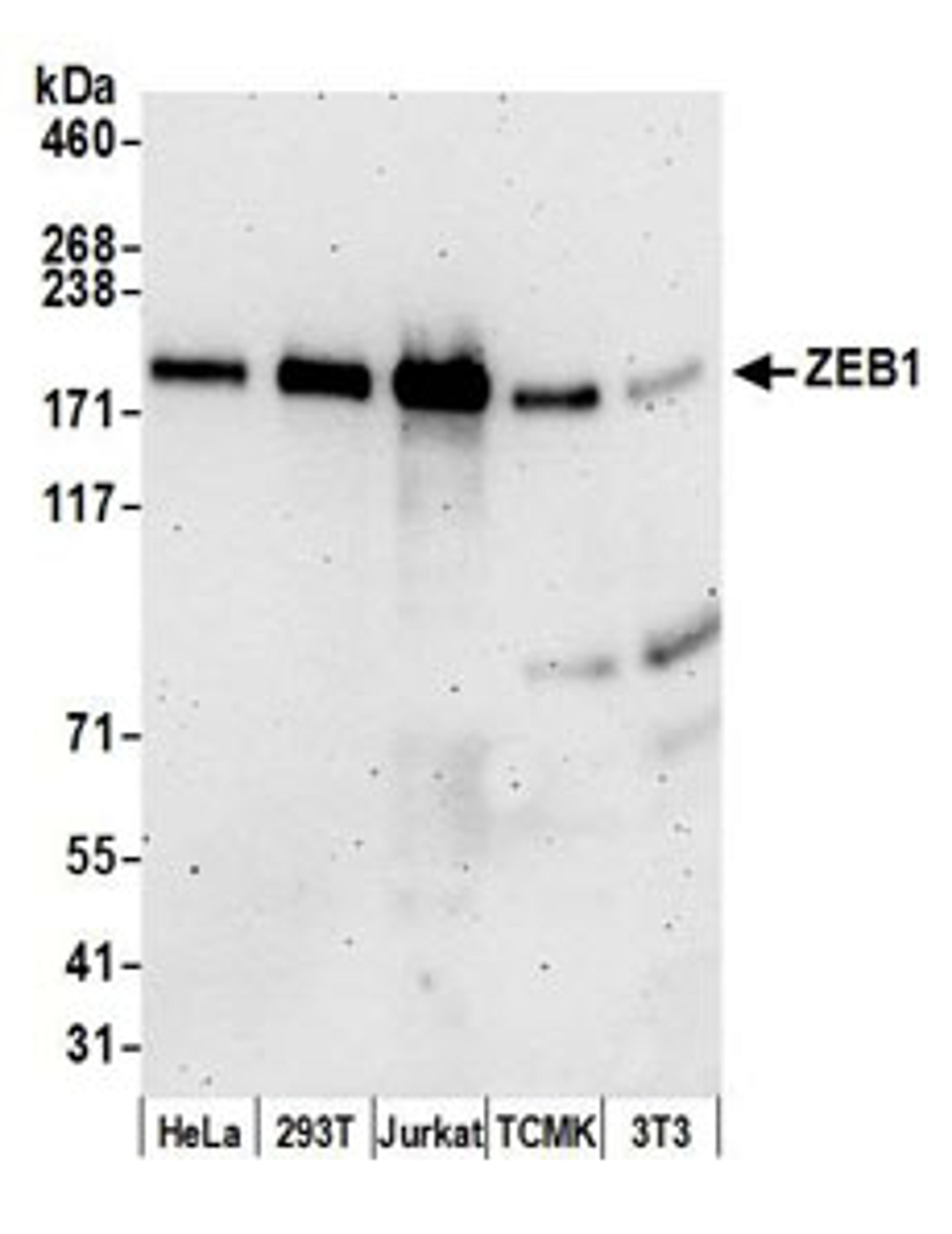 Detection of human and mouse ZEB1 by western blot.