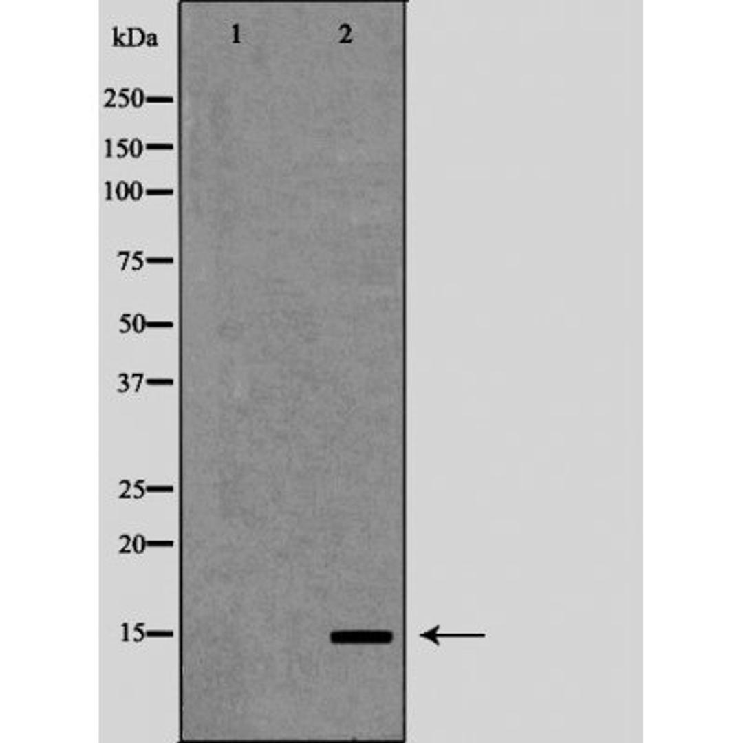 Western blot analysis of various cell lines using PFN1 antibody