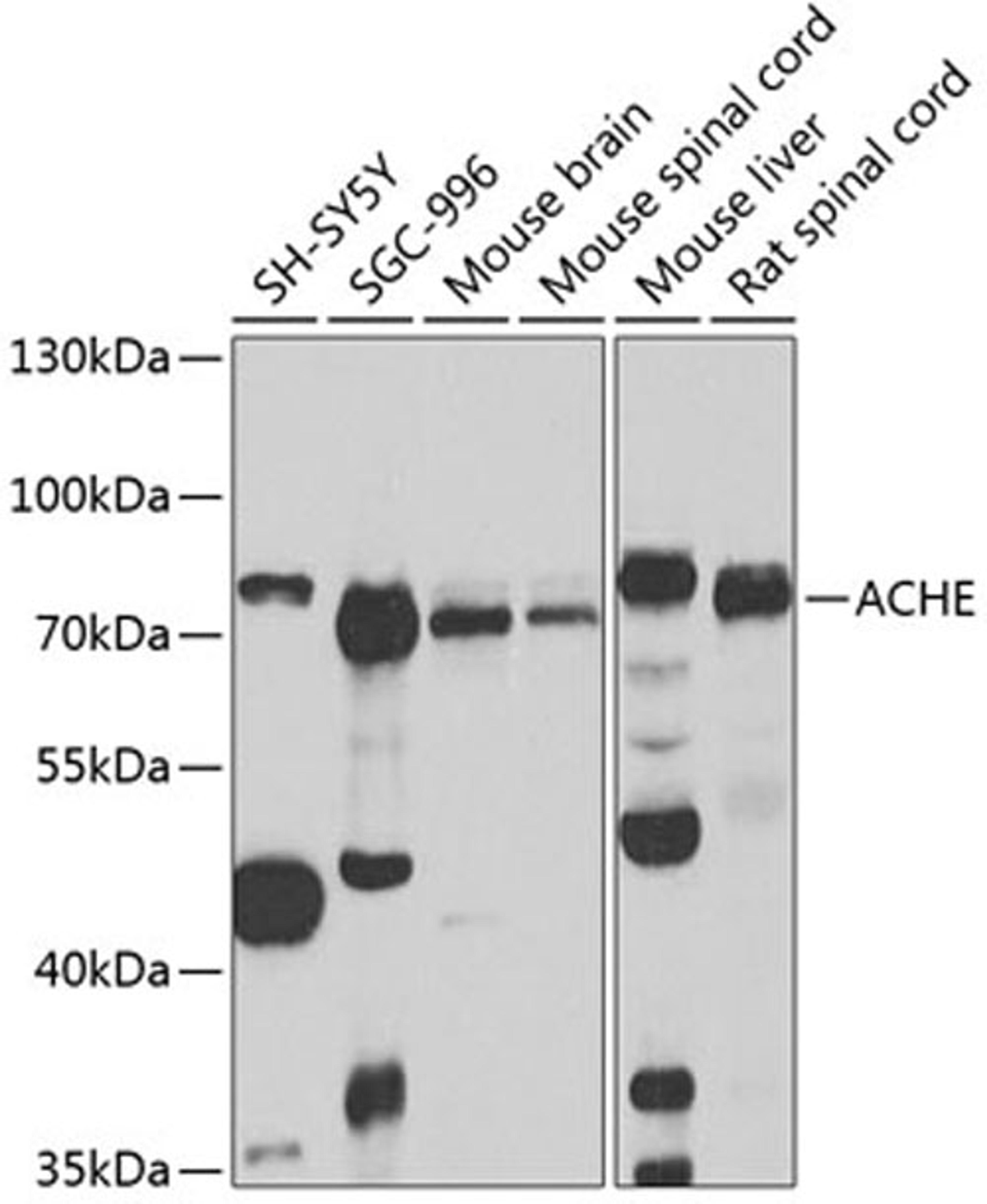 Western blot - ACHE antibody (A2806)