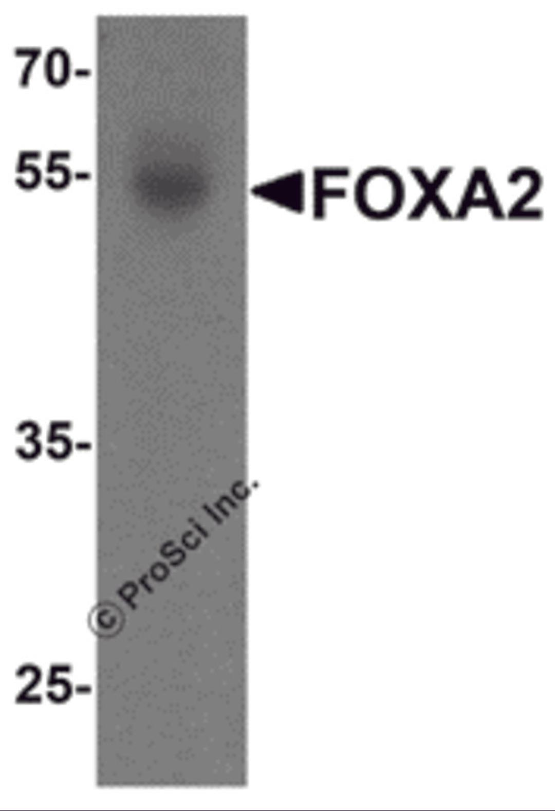 Western blot analysis of FOXA2 in human bladder tissue lysate with FOXA2 antibody at 1 &#956;g/mL.