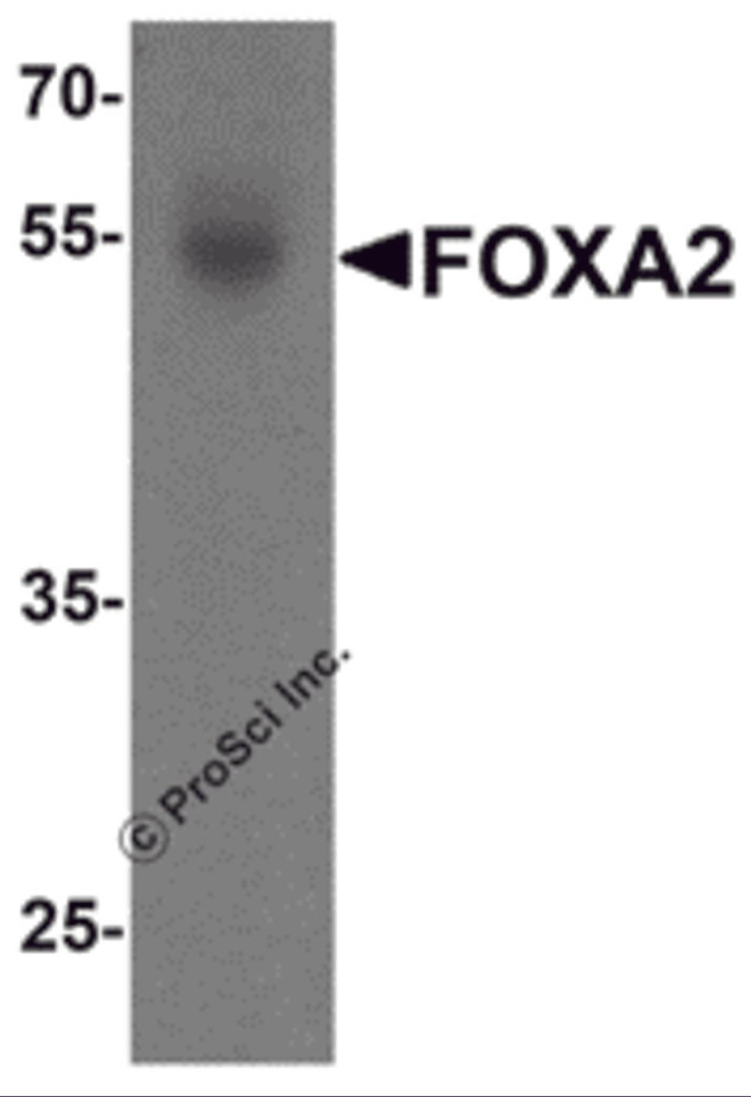 Western blot analysis of FOXA2 in human bladder tissue lysate with FOXA2 antibody at 1 μg/mL.